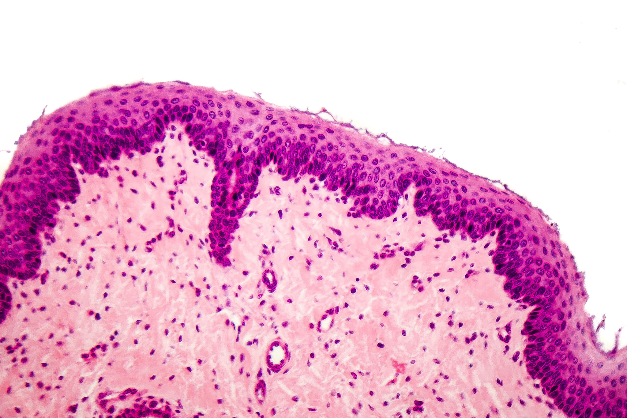 stratified squamous epithelium