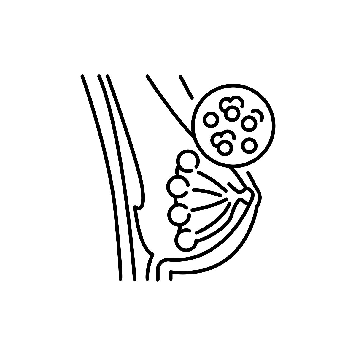 乳腺病理图片相关介绍