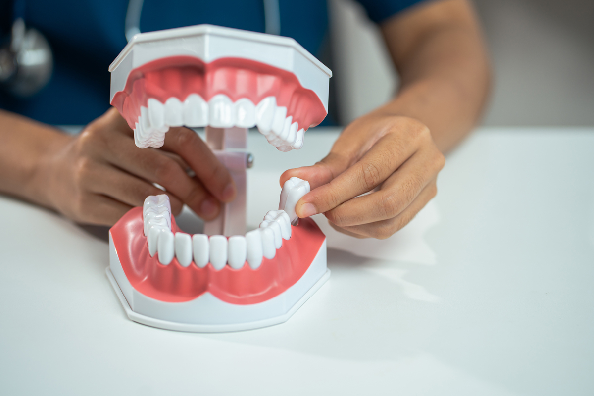 口腔修复前景广阔：技术革新、服务多元化，助您拥有健康美丽的口腔