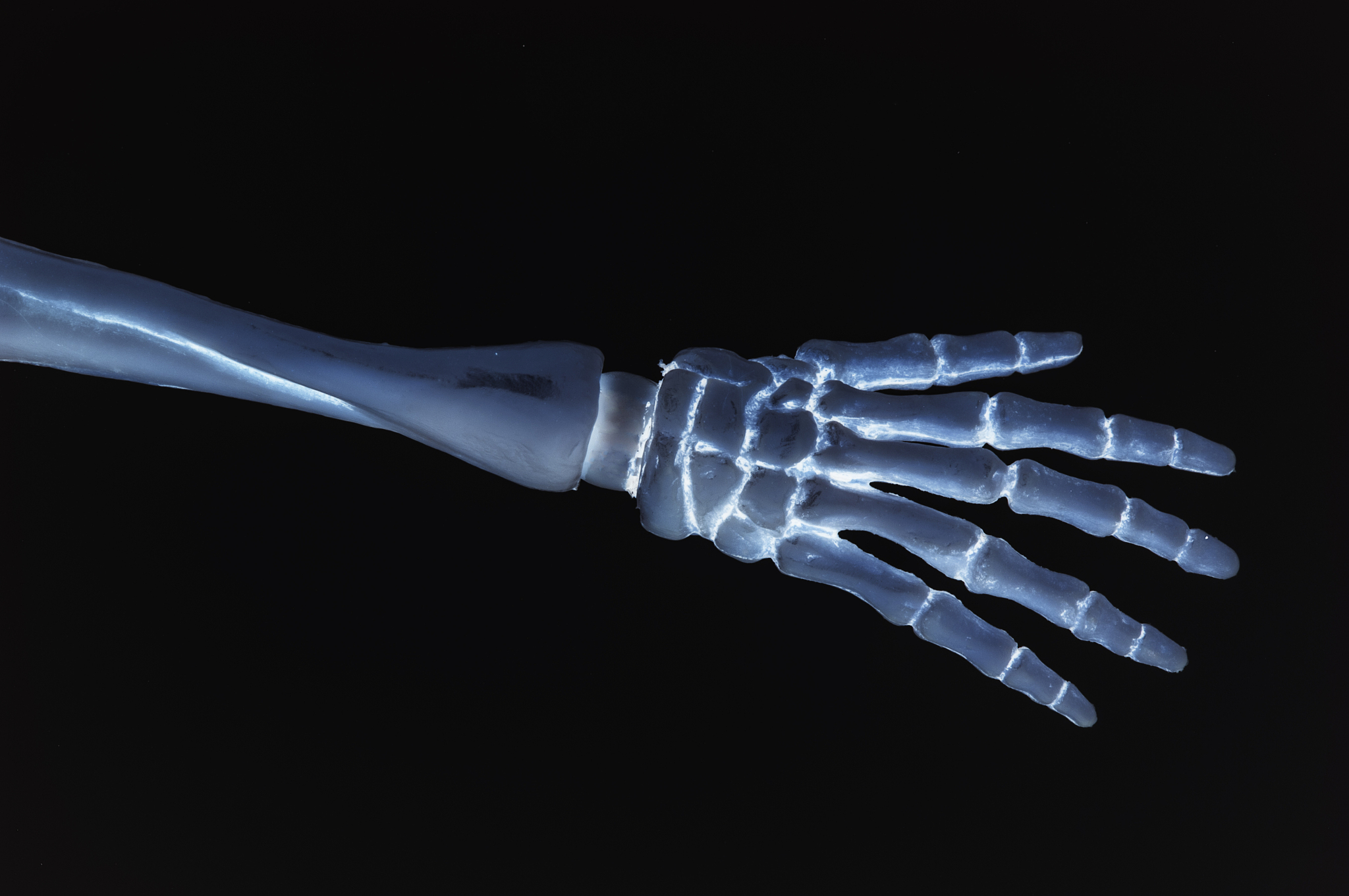 人体骨骼 - 手部结构图解