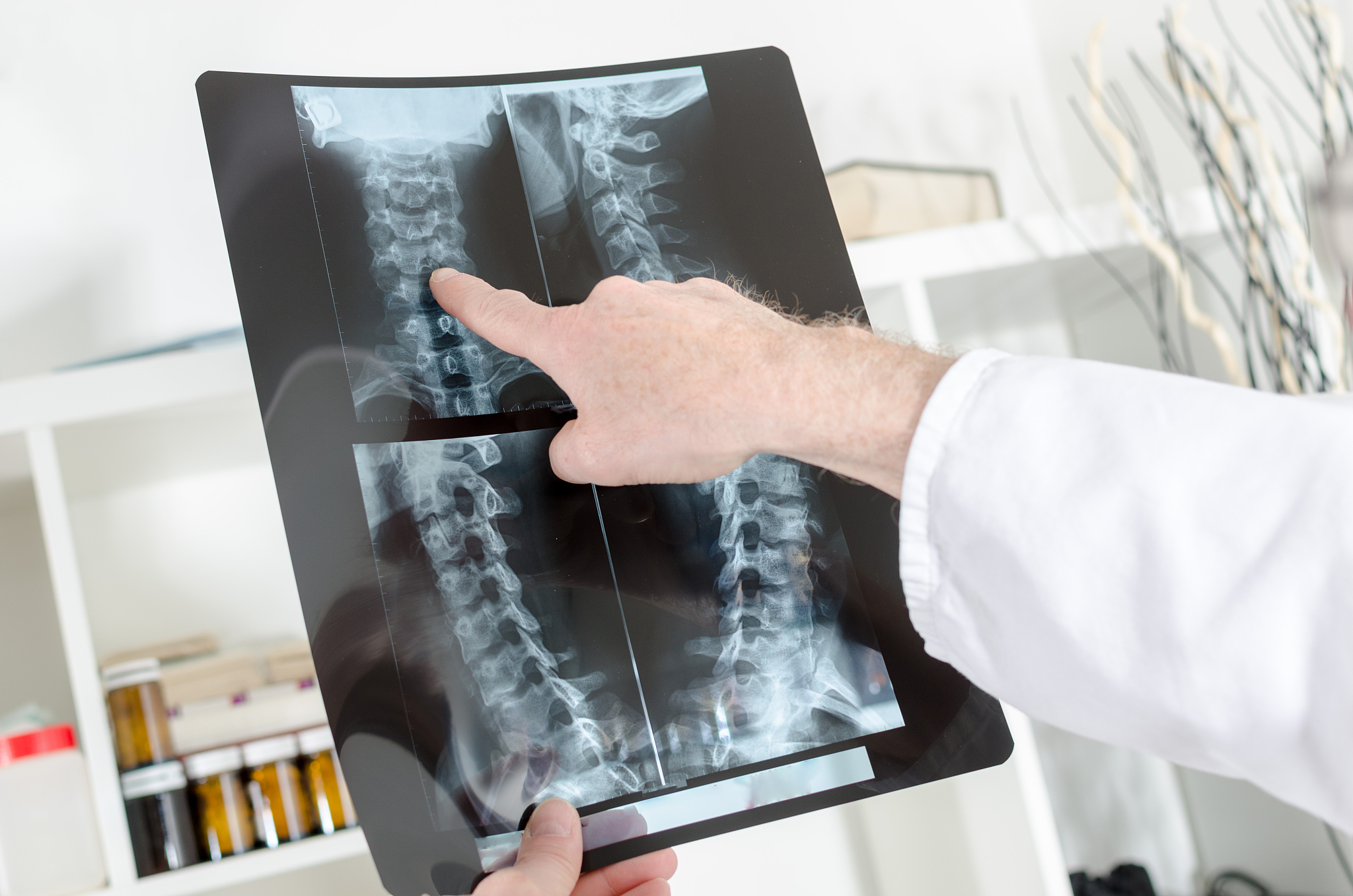 山东医学高等专科学校放射治疗技术专业就业前景如何