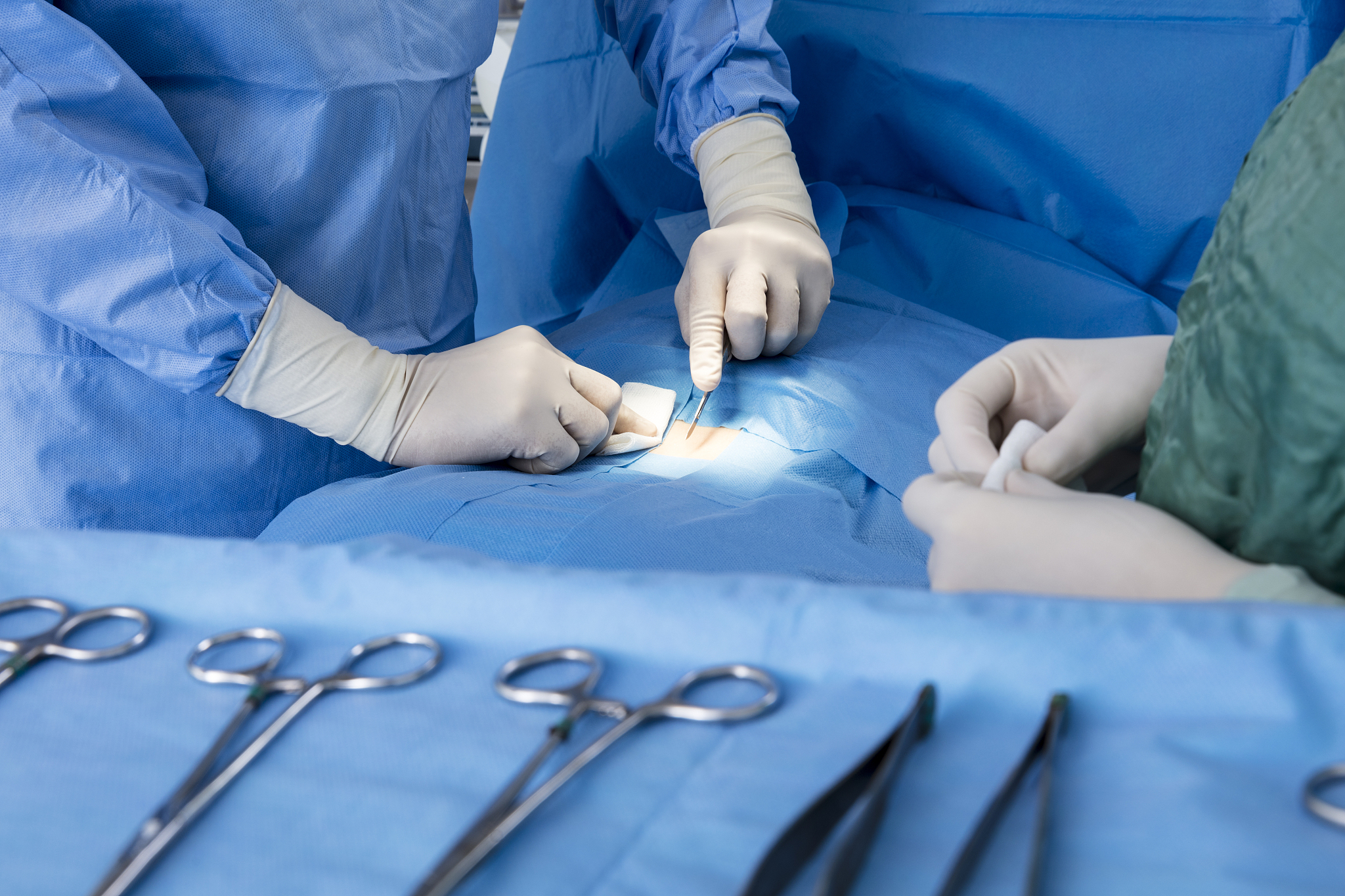 hands of doctors performing surgery in hospital operating room