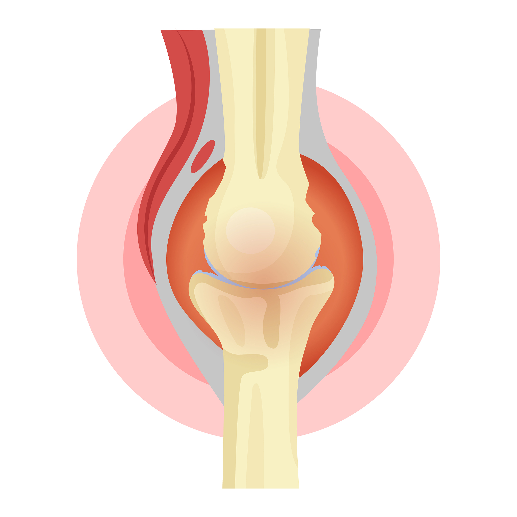 风湿是怎么引起的 英文一千字 带标题
