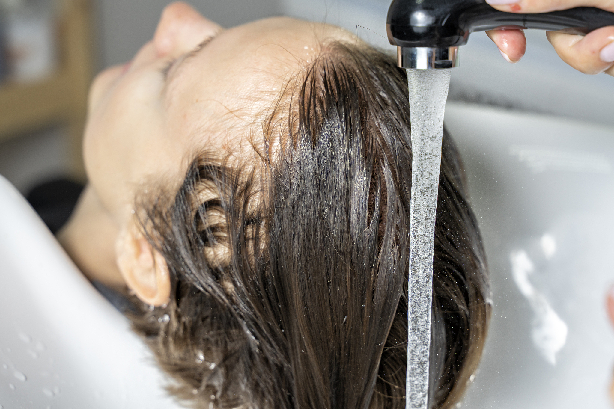 每天洗头发会掉发吗