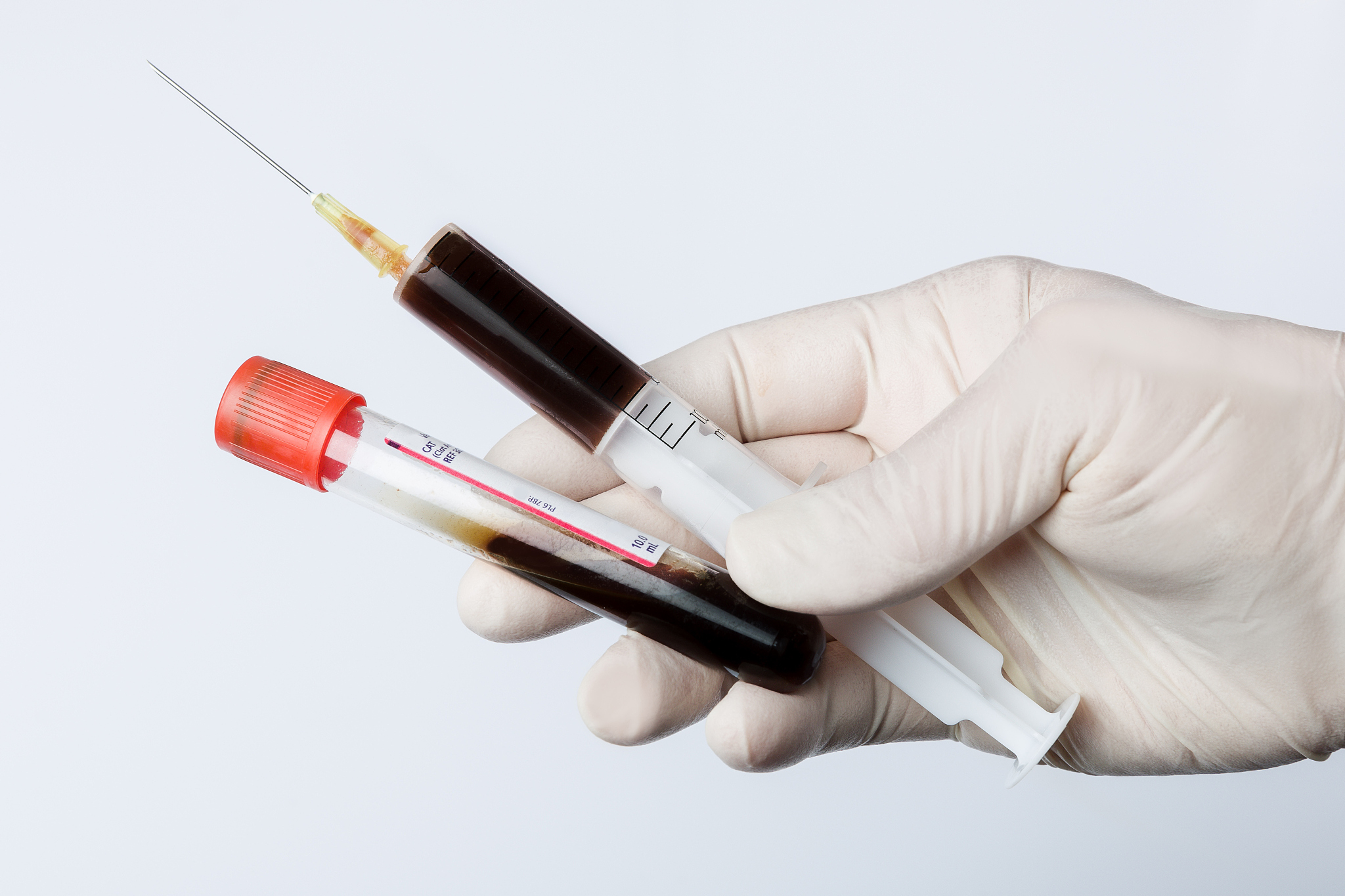 从哪些方面确诊为糖尿病？