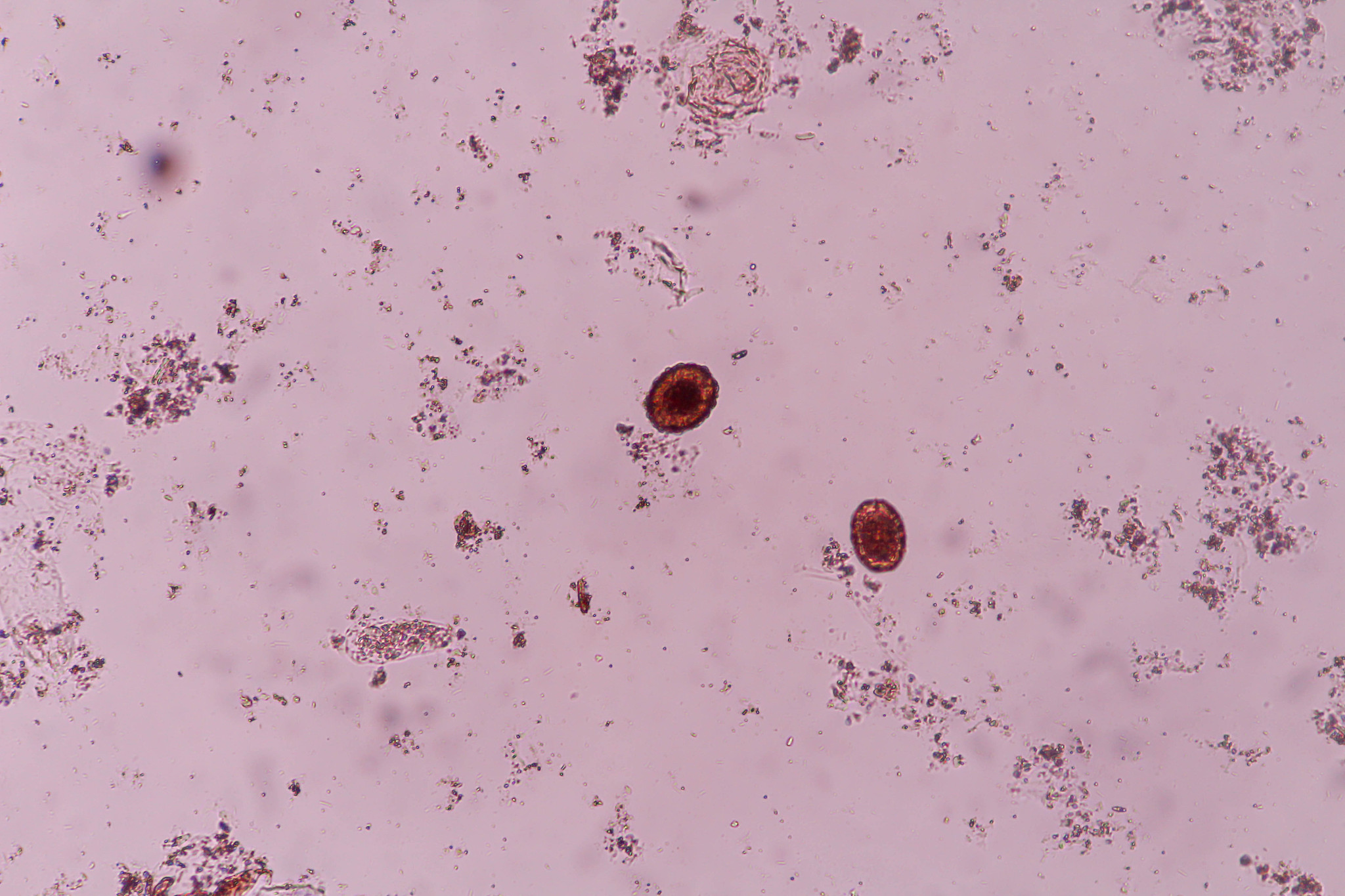 人体寄生虫学专业进修期间工作的总结突出进修收获、成果和体会是否达到预期目标