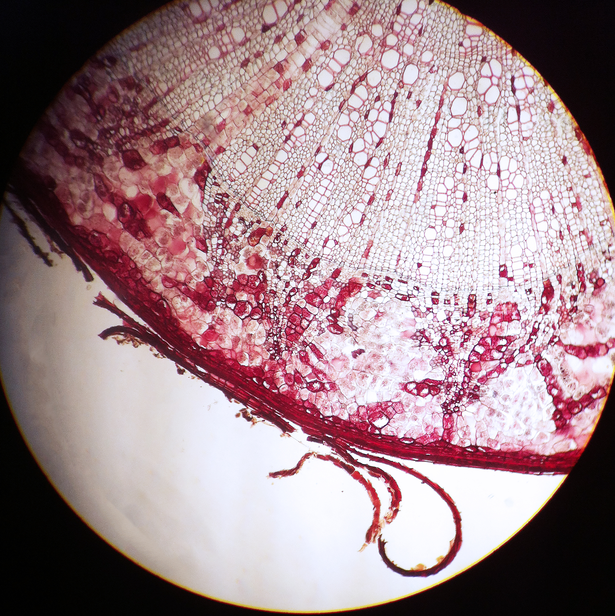 腹膜后脂肪肉瘤研究进展的综述