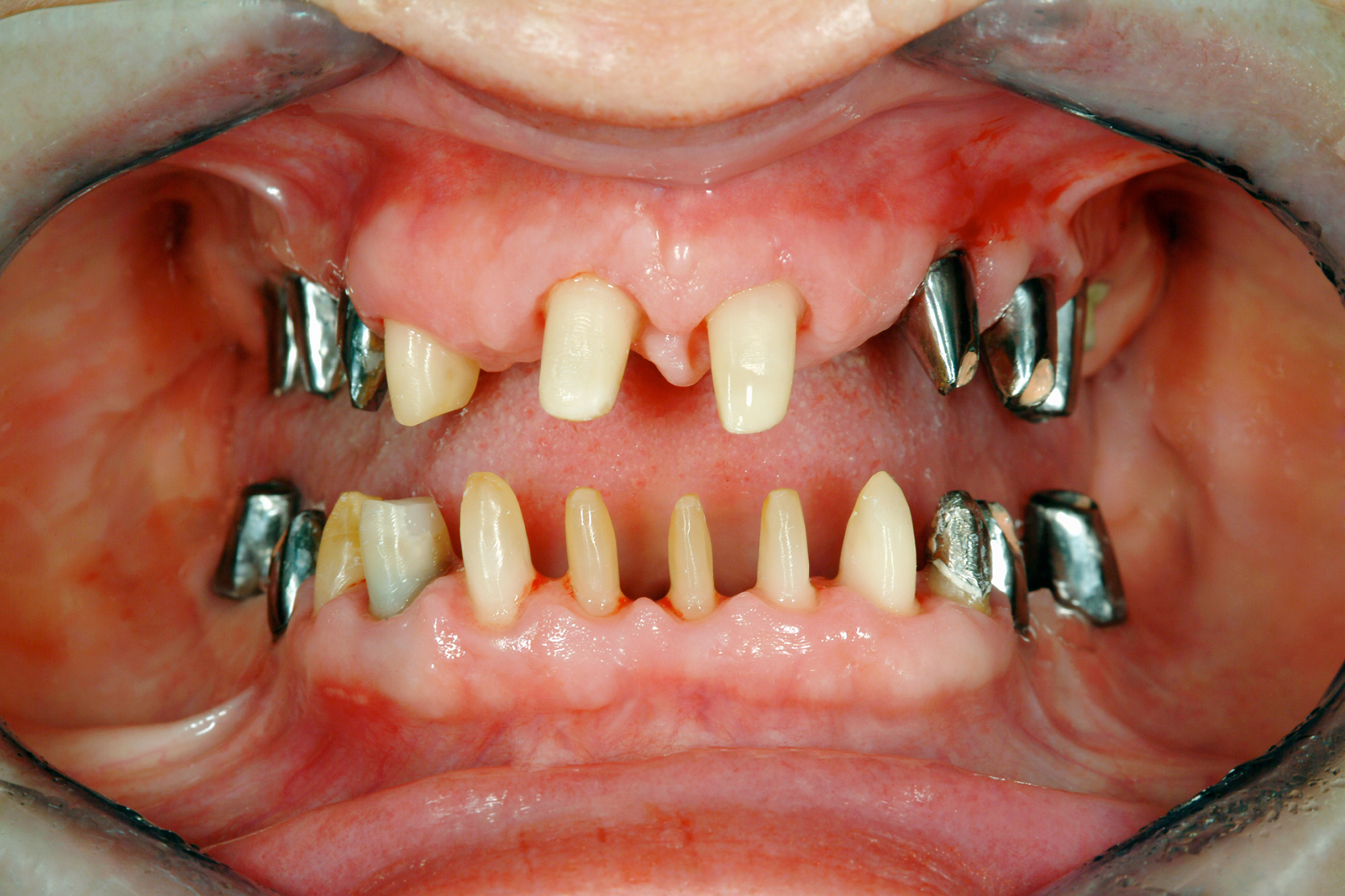 陇南卫生学校口腔修复工艺专业就业方向好不好？