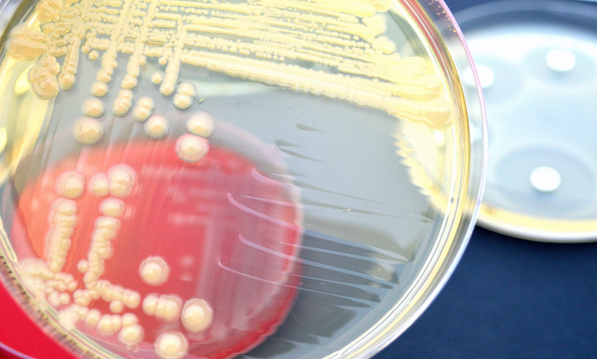 探究灵菌红素对感染金黄色葡萄球菌的小鼠肠道的影响实验中，经常被用到的菌类有哪些？