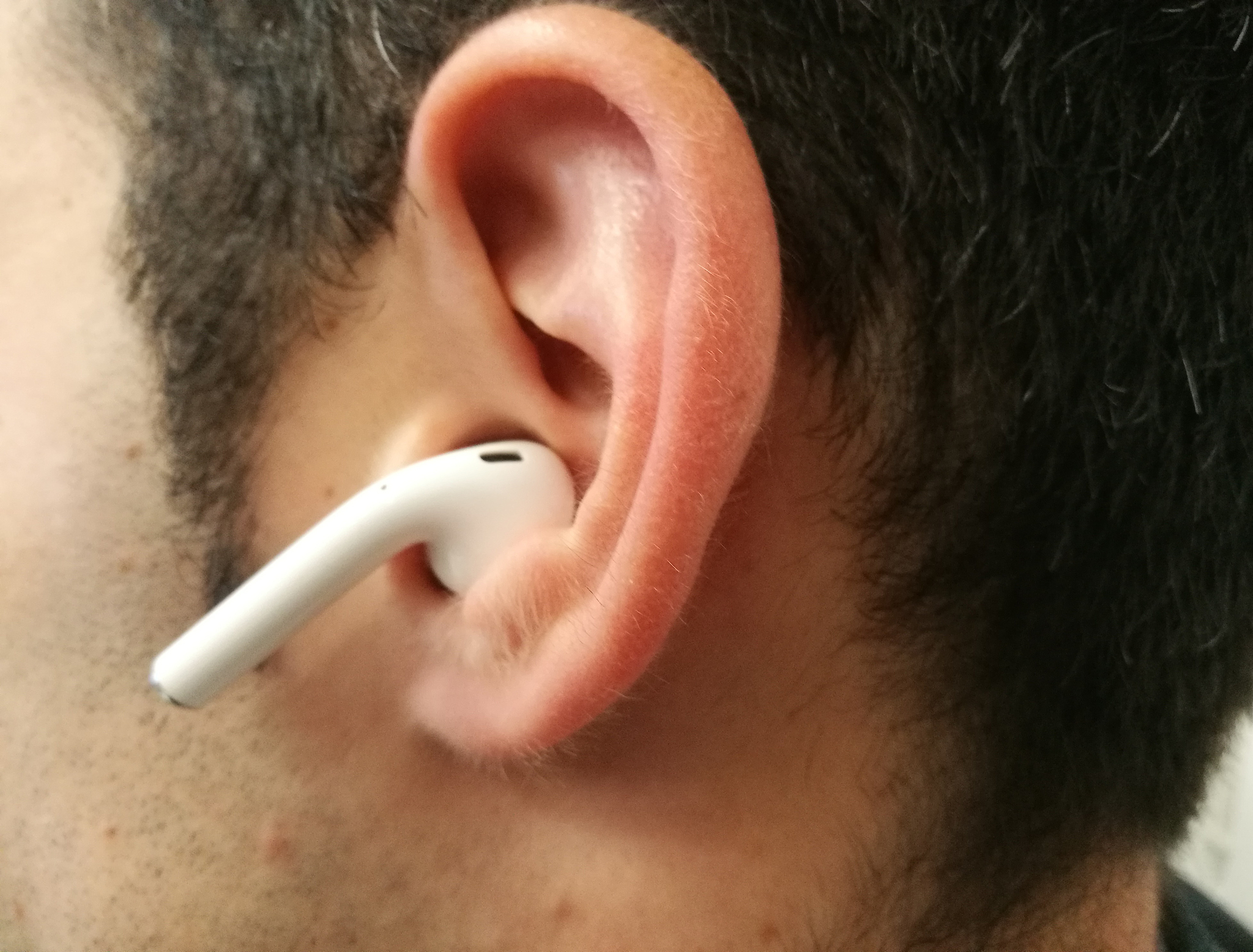 蓝牙耳机坏了是去看牙科还是耳科