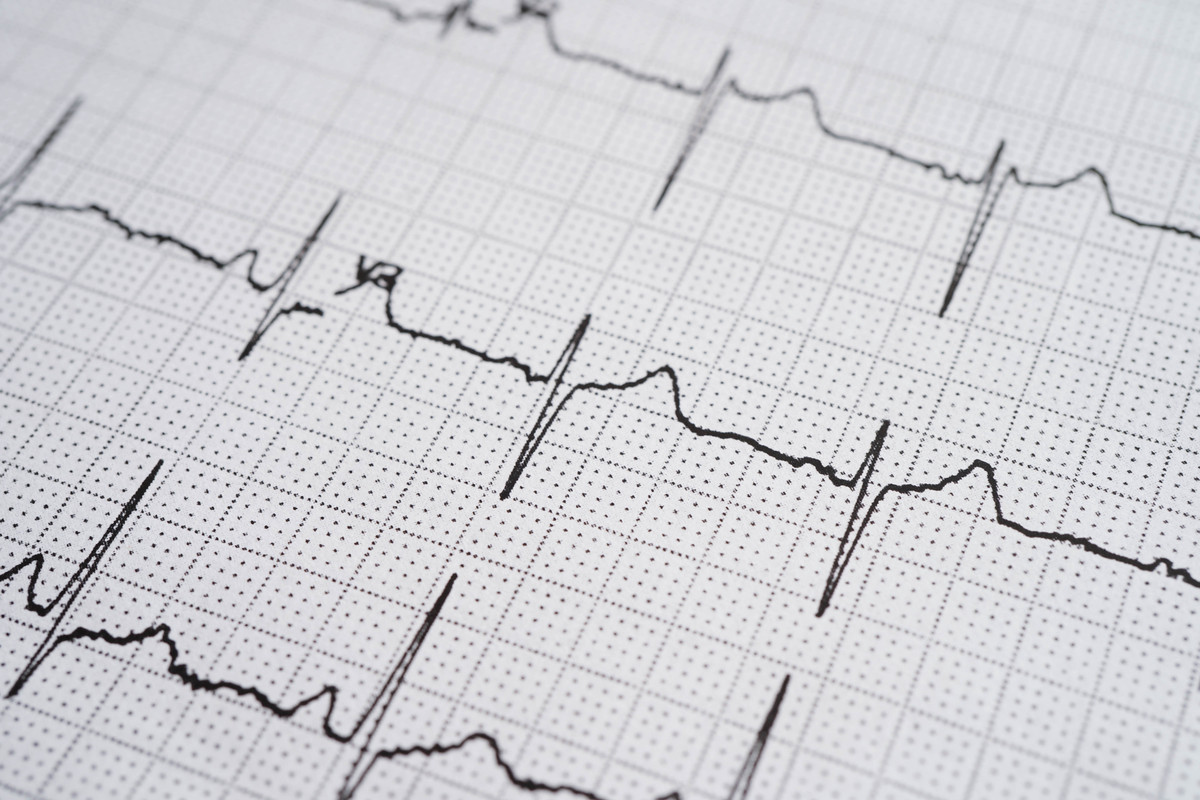 心电图的作用有哪些？