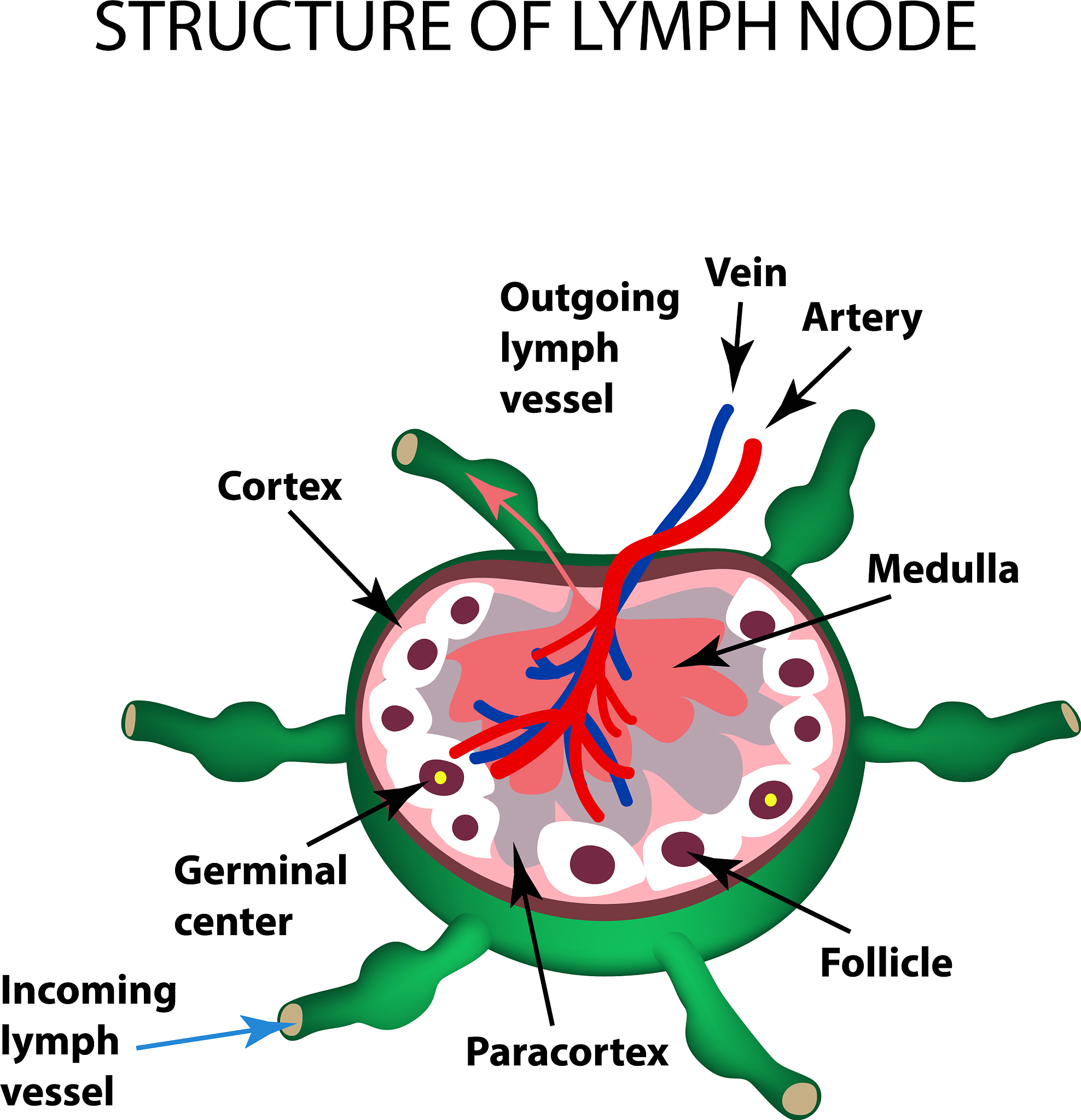 请问你知道坏死性淋巴结炎吗？