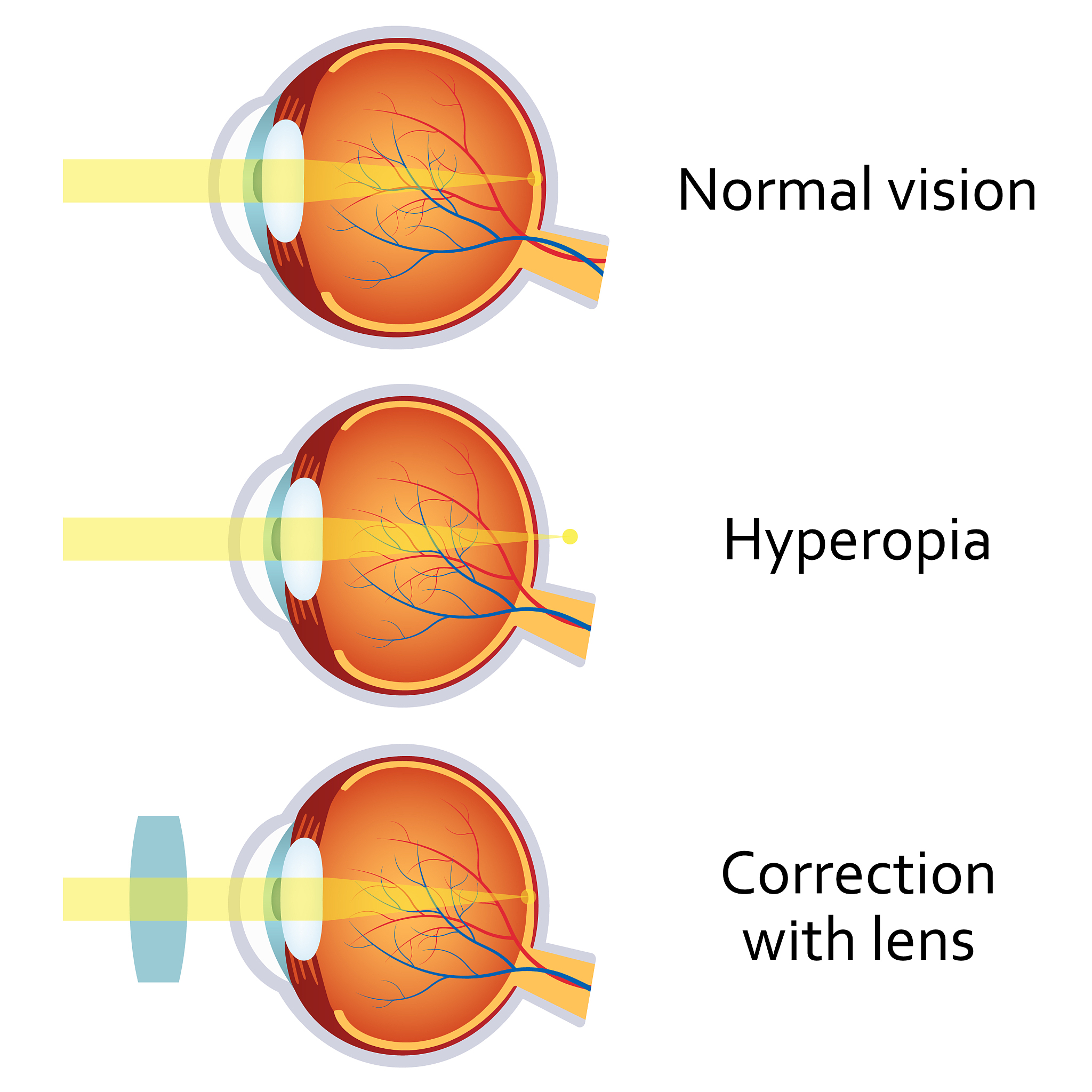 天津医科大学视力要求？用发散
