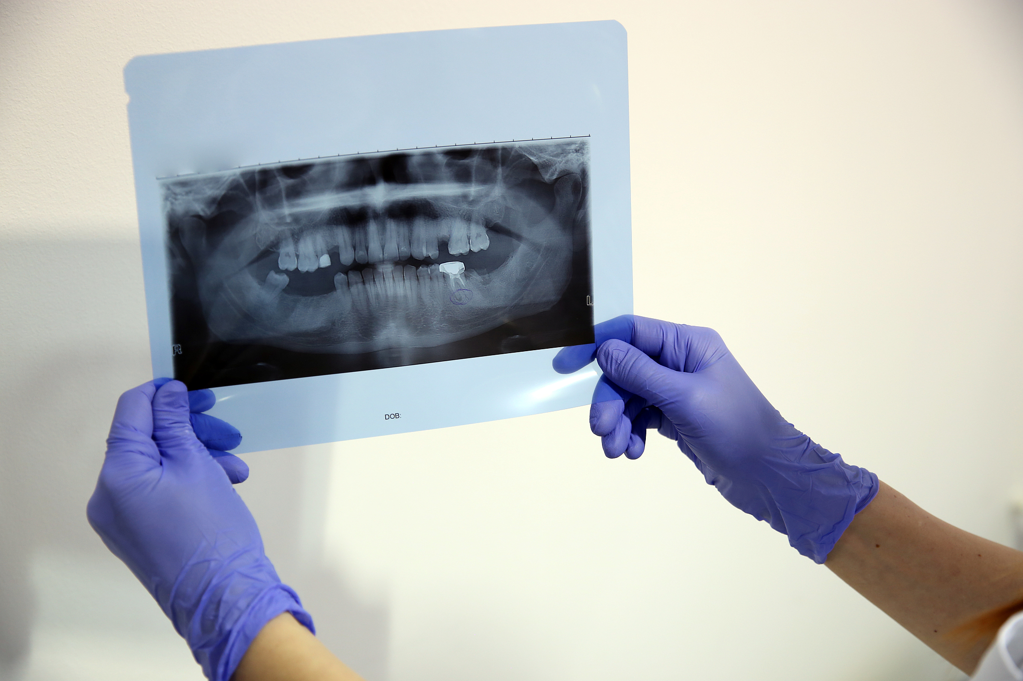 2020年重庆三峡医药高专口腔医学技术专业招生 | 培养口腔医学人才