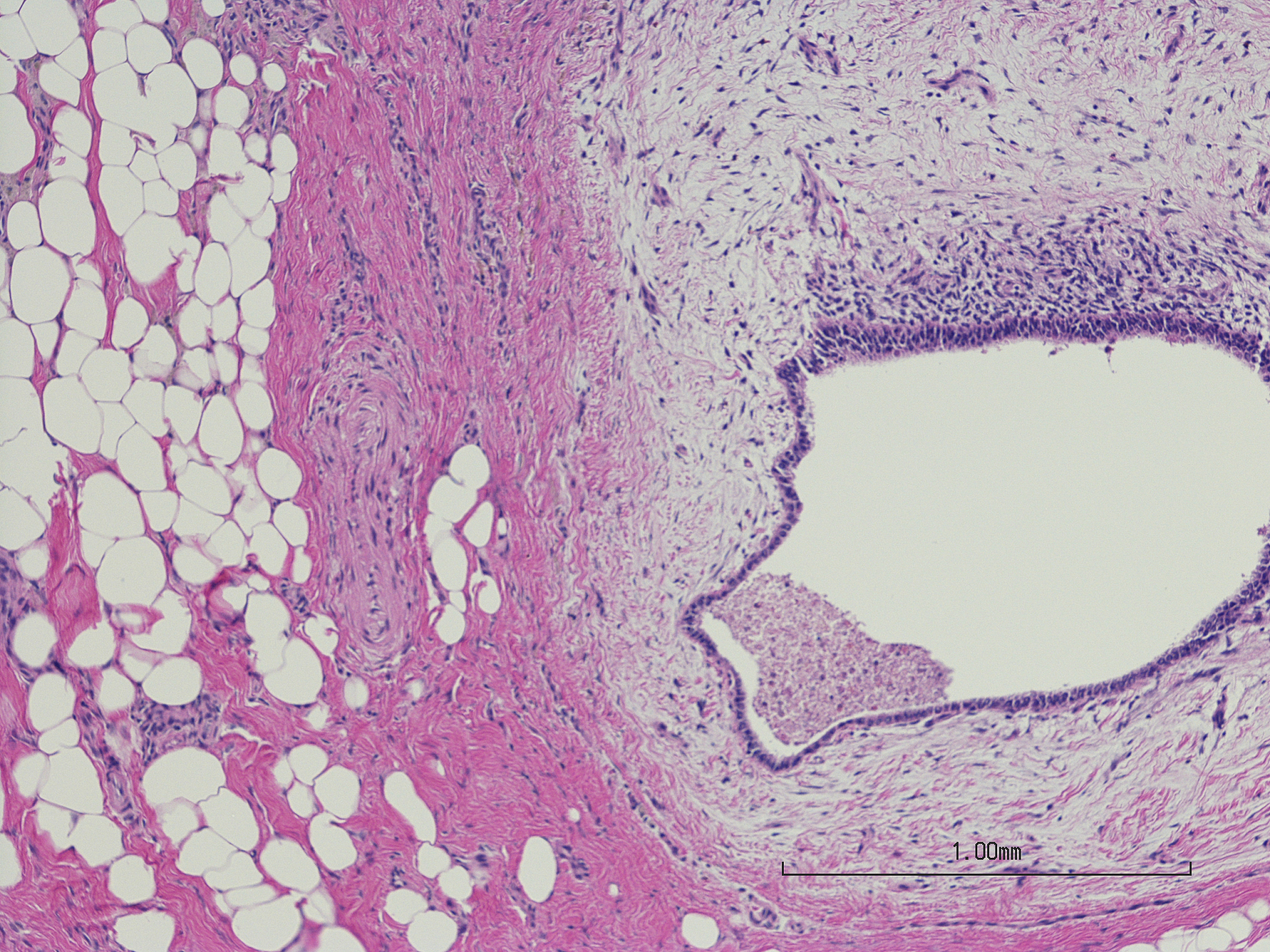 瘢痕子宫怎么办？全面了解护理与治疗方法