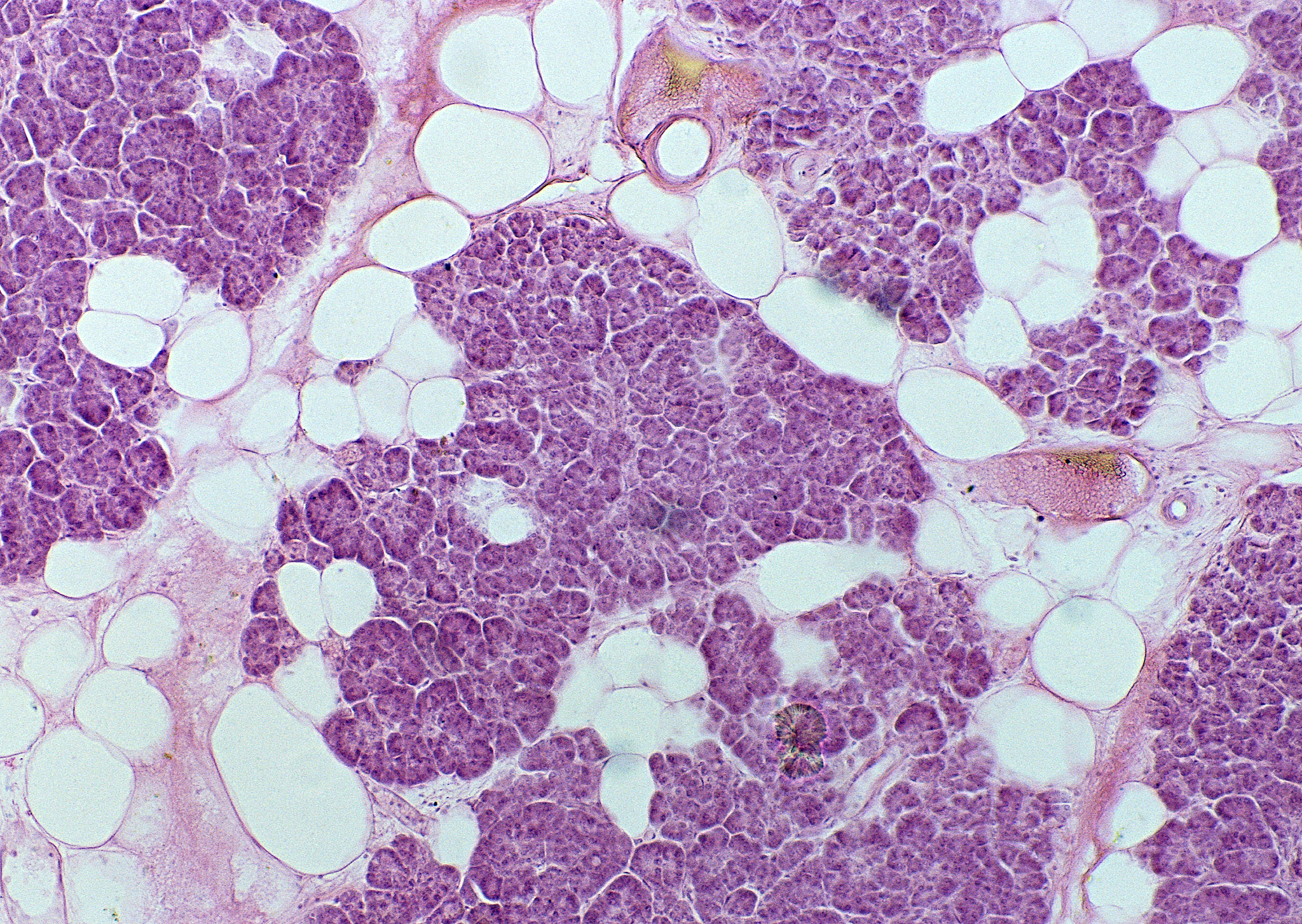 肝星状细胞促进肝脏纤维化机制