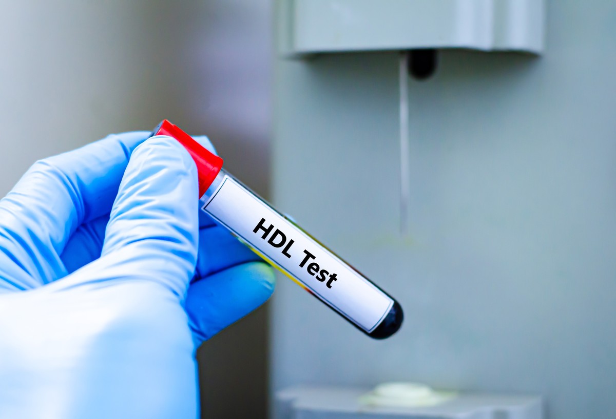 抽血培养的时机