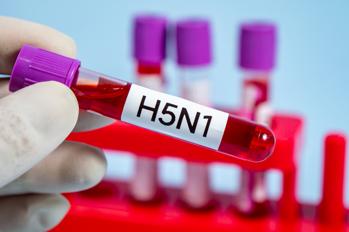 艾滋病疫苗研发面临哪些挑战？为何至今没有疫苗可以预防？