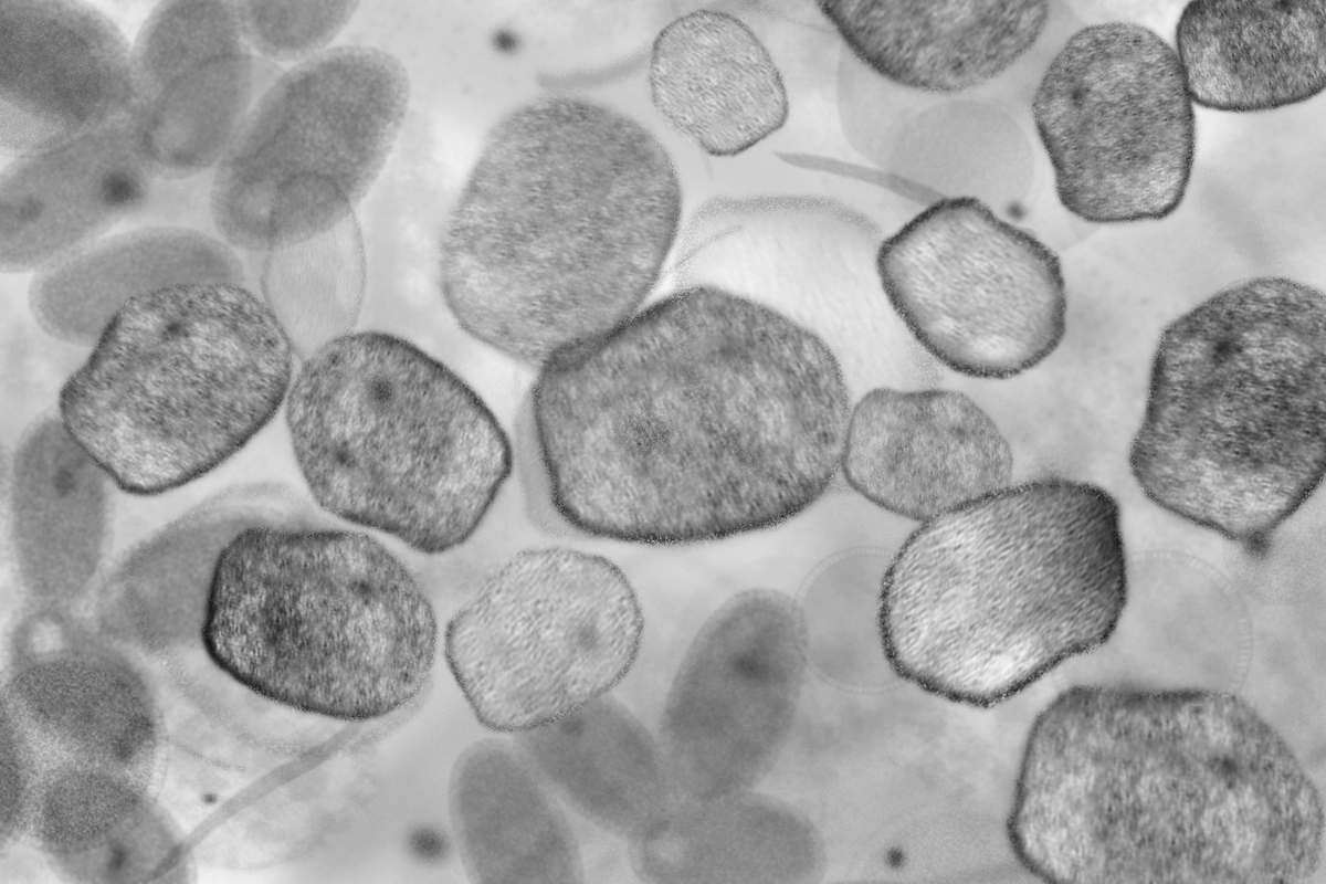 透射电镜观察内质网应激指标：形态、膜完整性、蛋白定位及表达