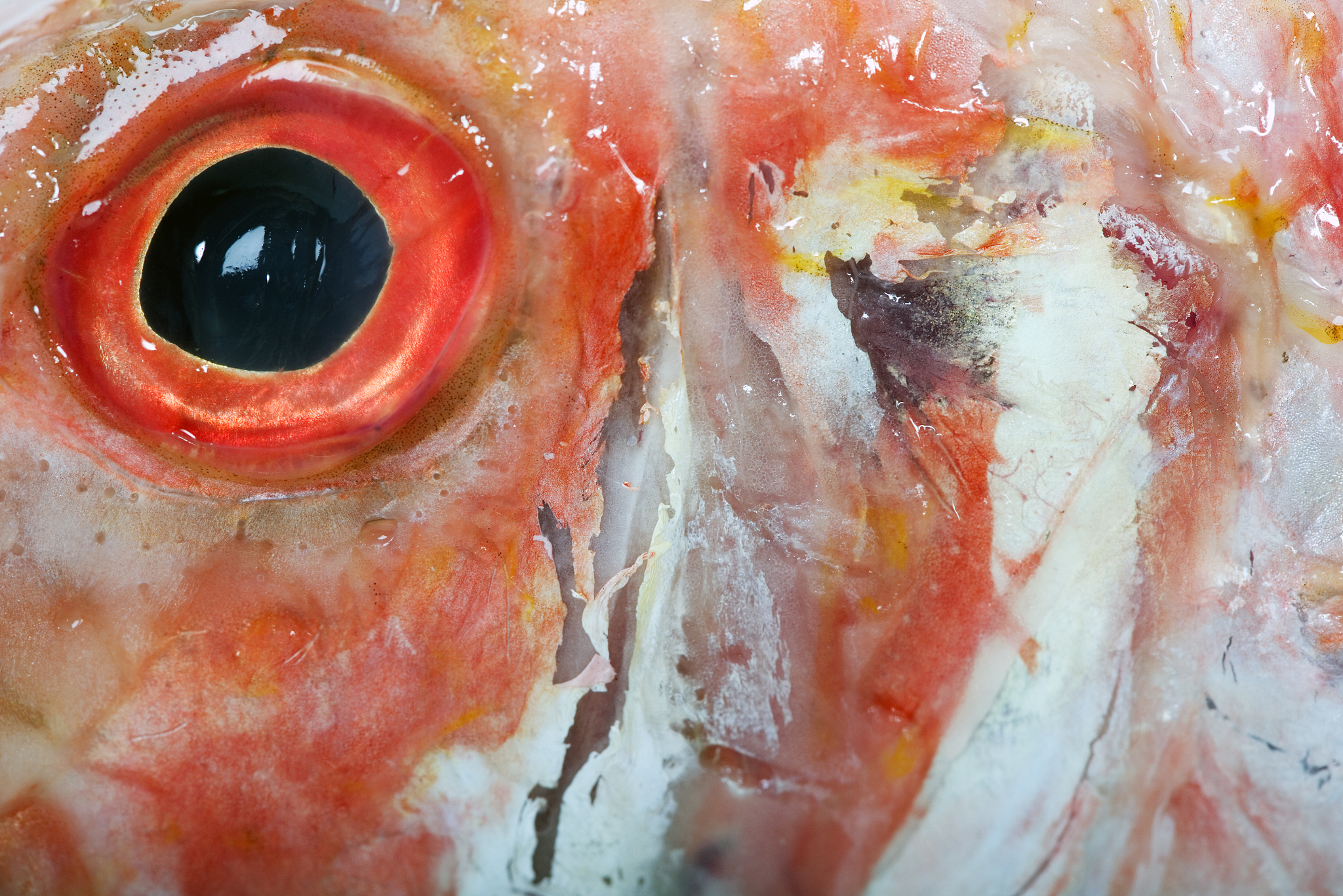 眼部蛲虫病：蛲虫会寄生在眼睛里吗？