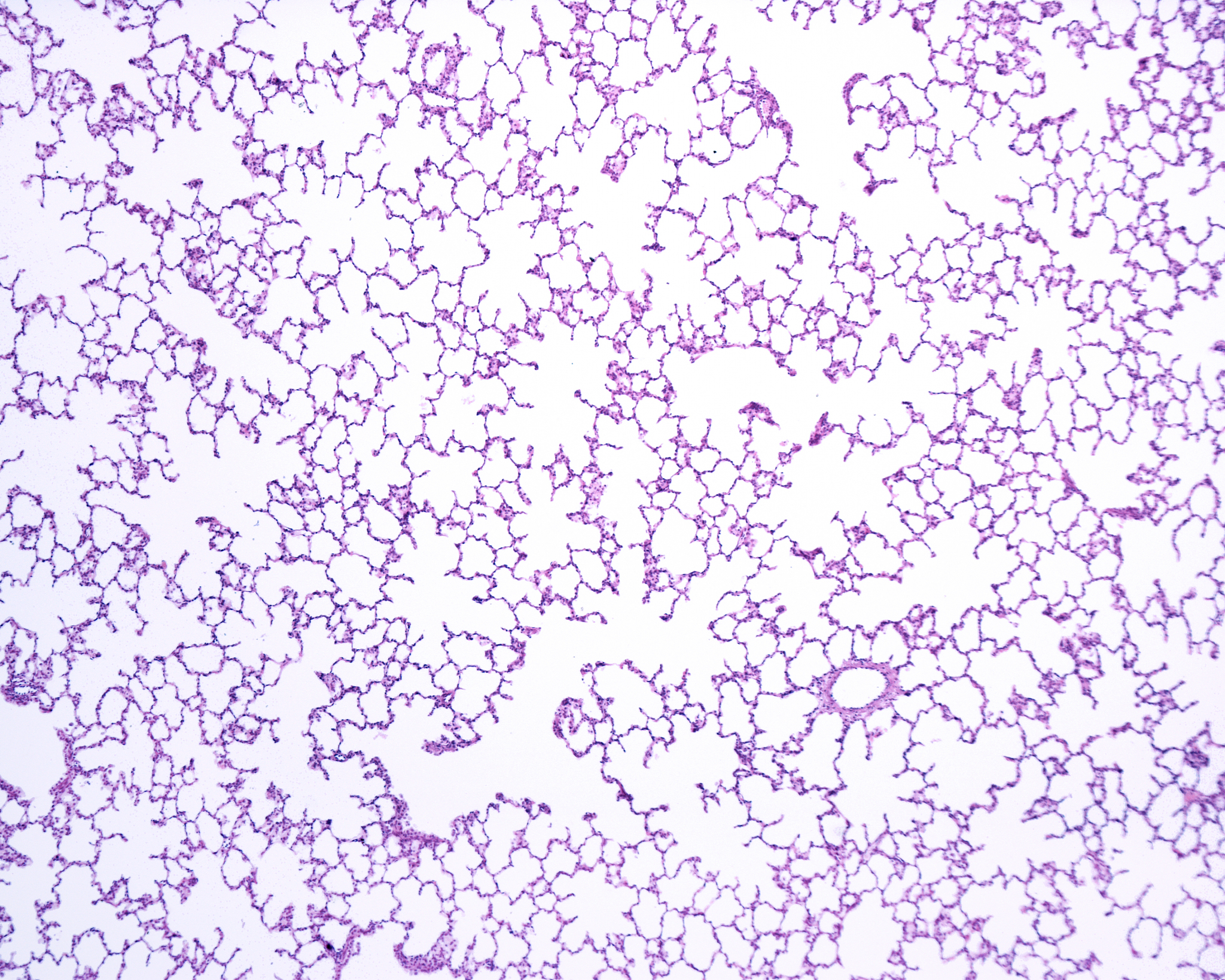 lung parenchyma