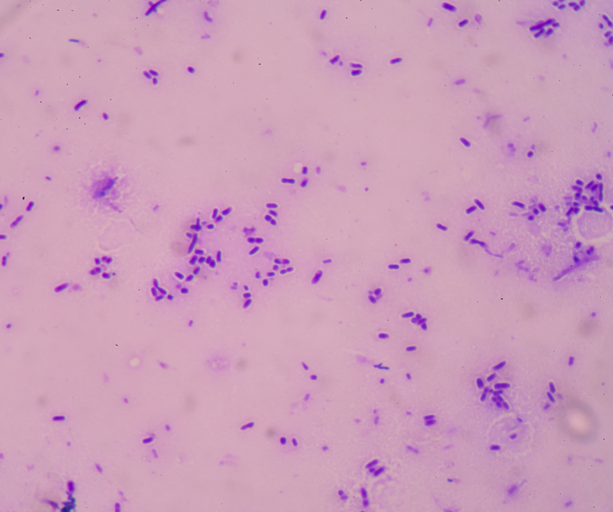 类鼻疽伯克霍尔德菌的别称 - 伯克霍尔德菌、鼻疽菌、木脑菌
