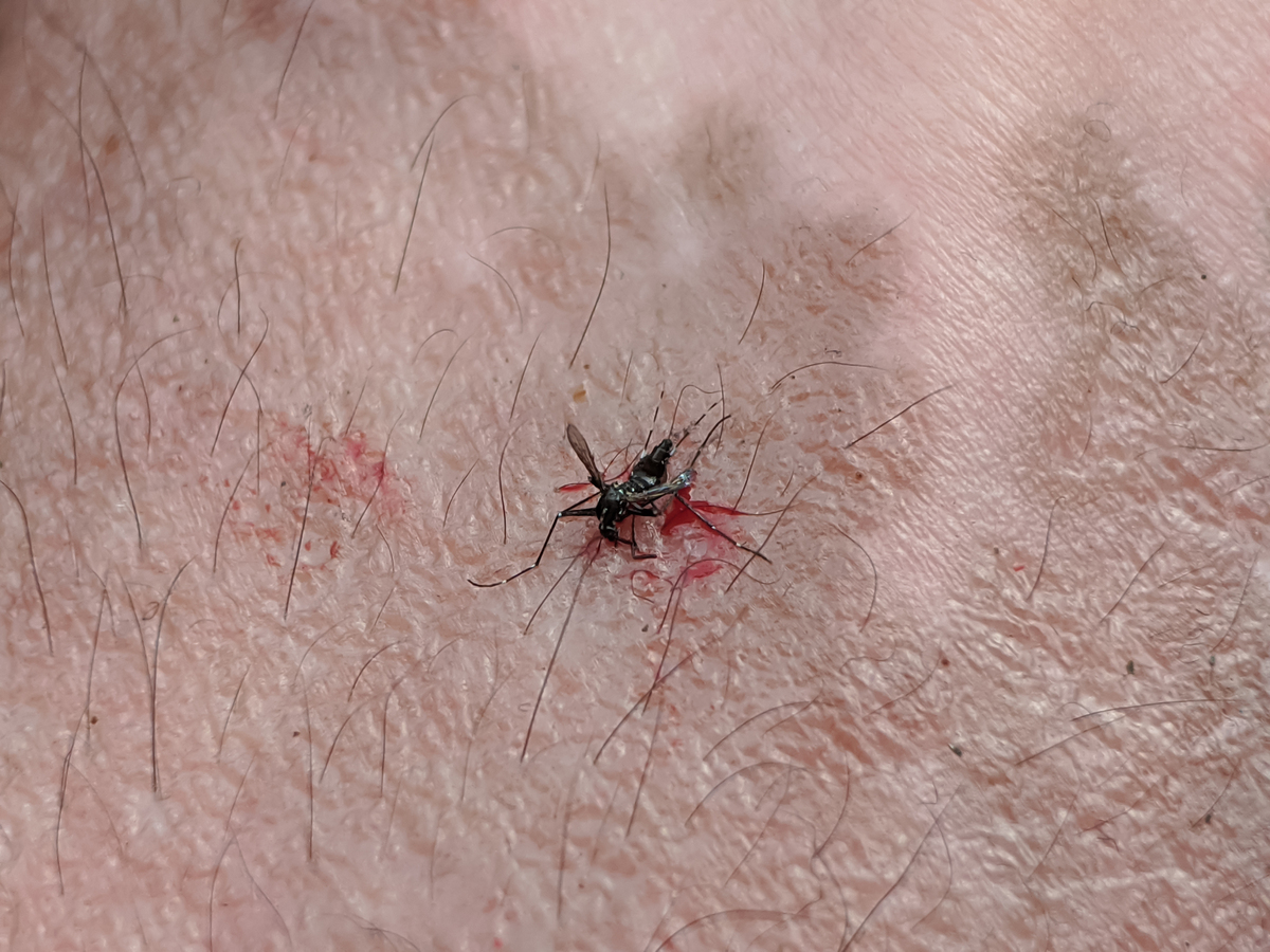 我从海南回来在那边可能被那边的小黑虫咬了到现在已经有二十多天了 回来好像越来越严重了现在能怎么治疗