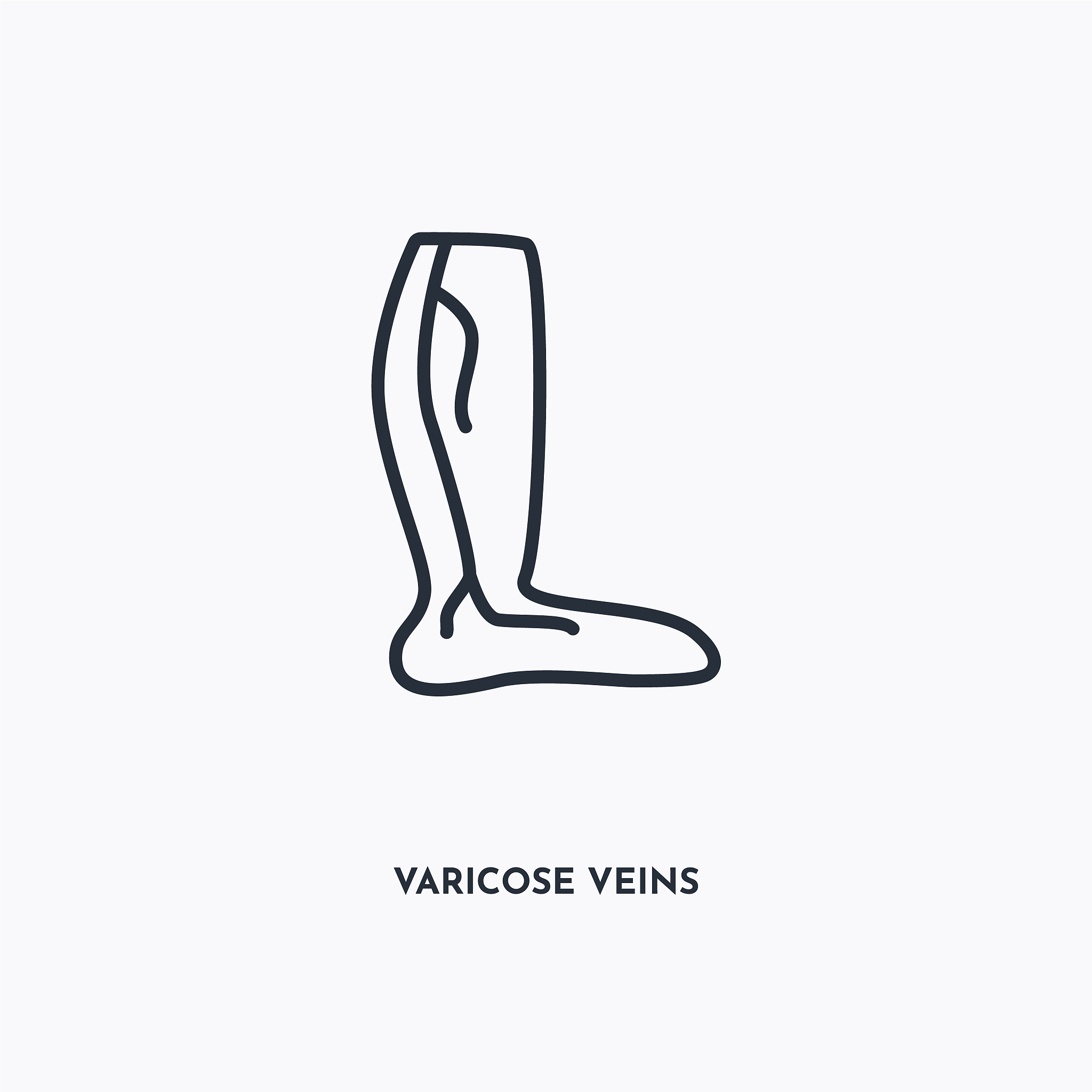 下肢静脉曲张原因：遗传、职业和孕妇