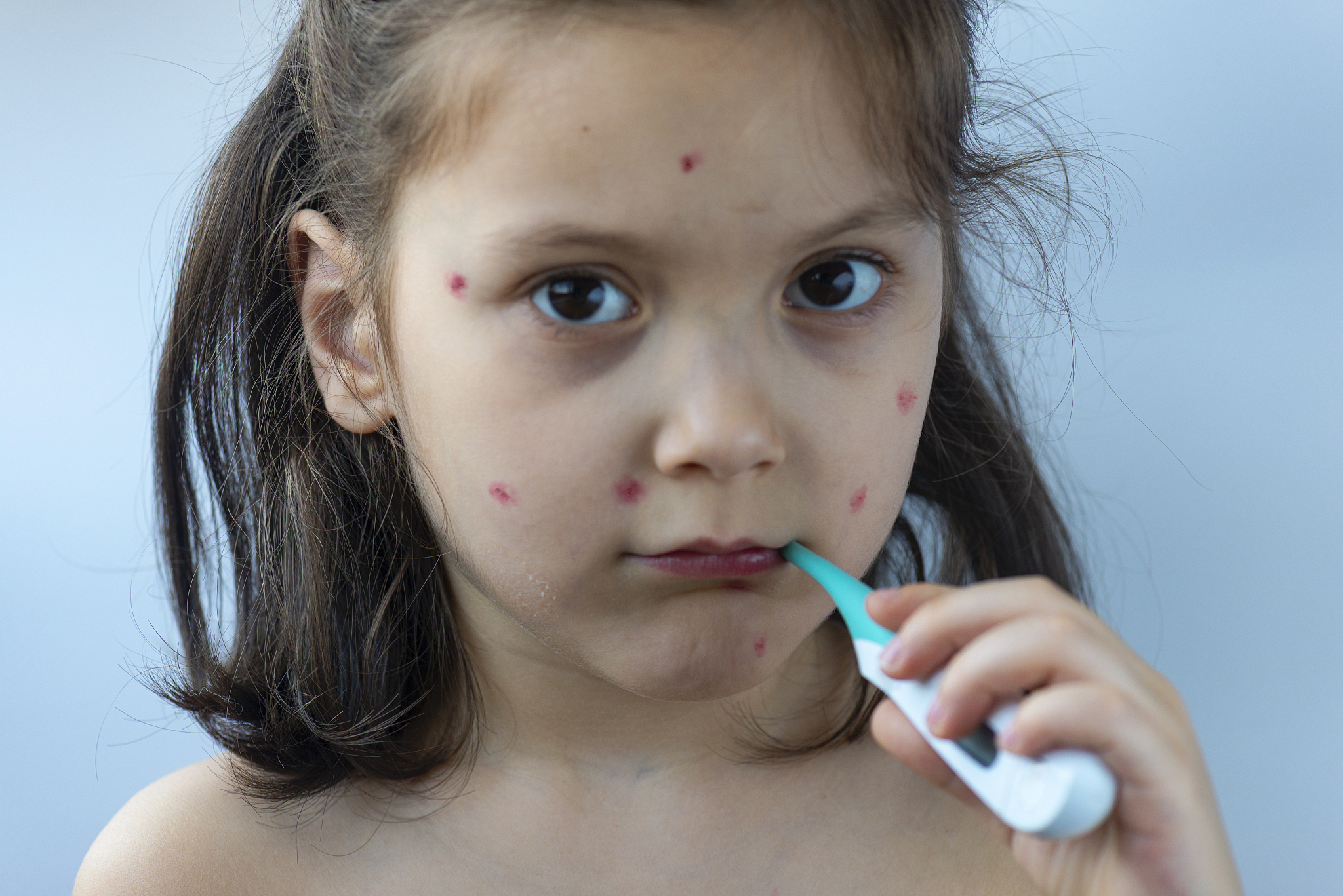 girl with a thermometer