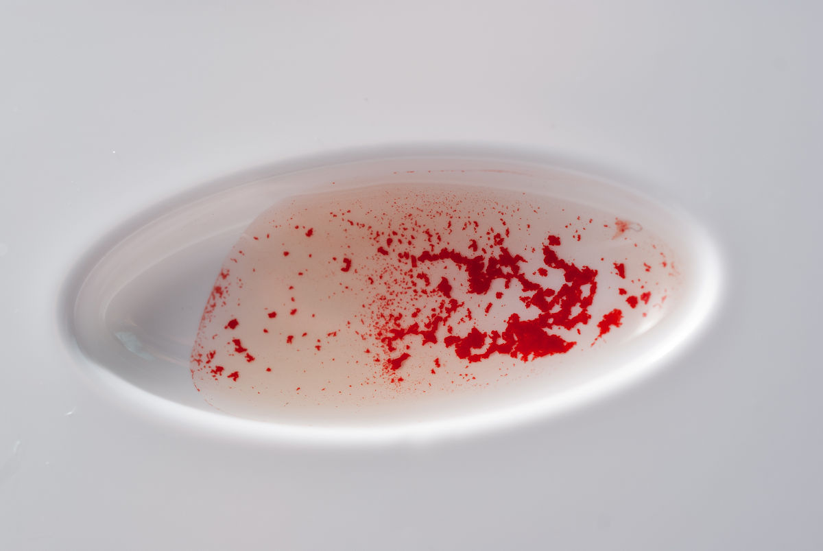 用孕妇血液能检测胎儿血型吗