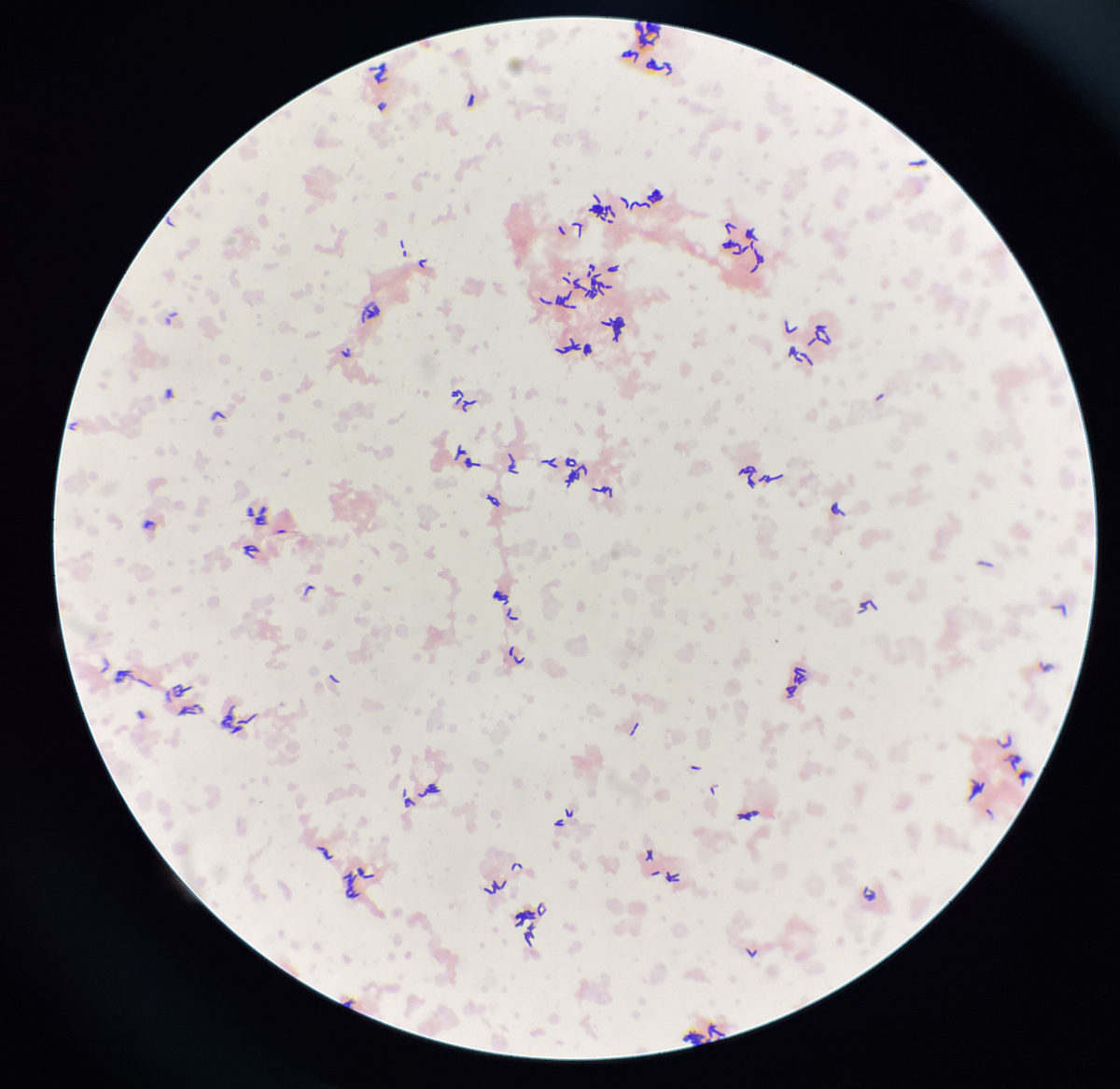 Critical Evaluation of Dendritic Cell Impairment and HSD11B1 Expression in Endometriosis: A Study by Xu Yang et al.