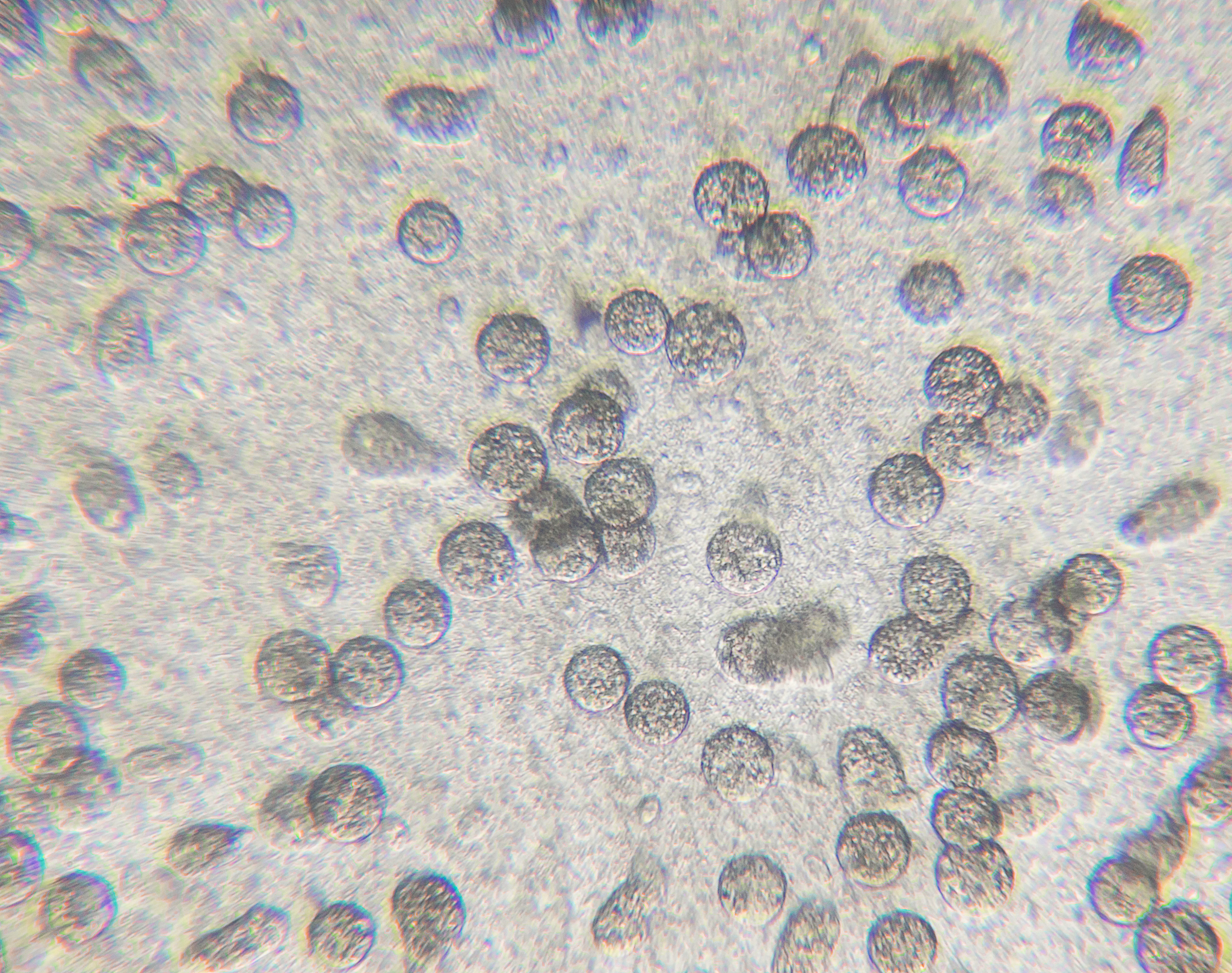 请准确学术地翻译一下这段话。We also compared the ultrastructure of spacious versus condensed LCVs by correlative light and electron microscopy CLEM within U937 macrophages Fig 3H At 10 hpi vacuoles containing Lp02