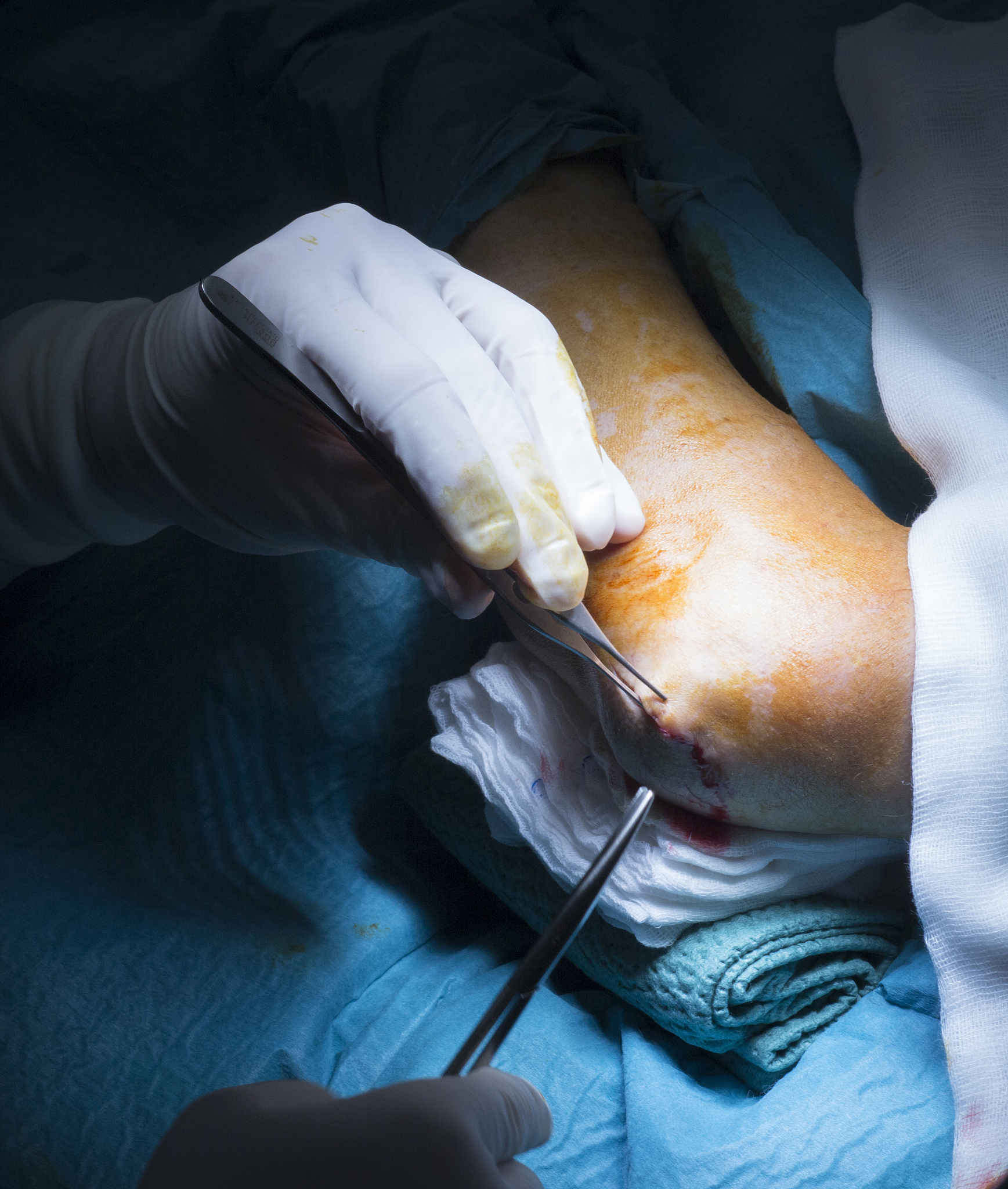 hospital elbow orthopedics surgery operation