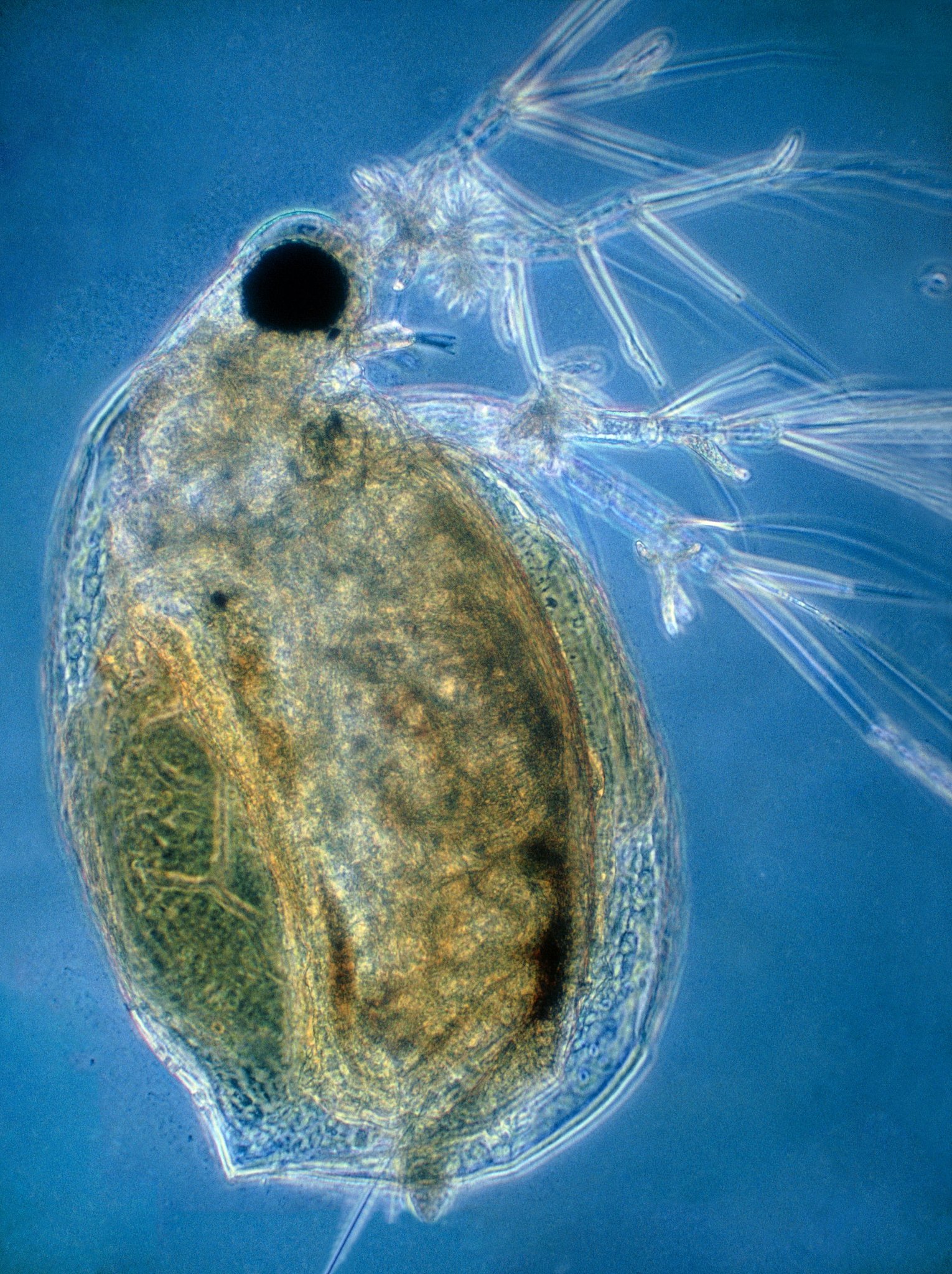 生物污染是指各种细菌、病毒、寄生虫等微生物对水体造成的污染。这些微生物会引起各种疾病危害人类健康。