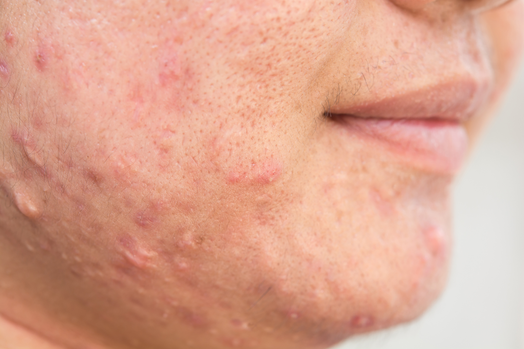 scar on face