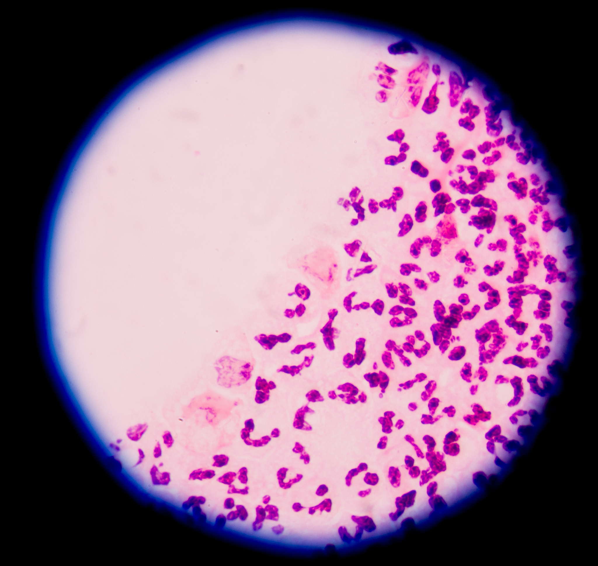 免疫组化的步骤