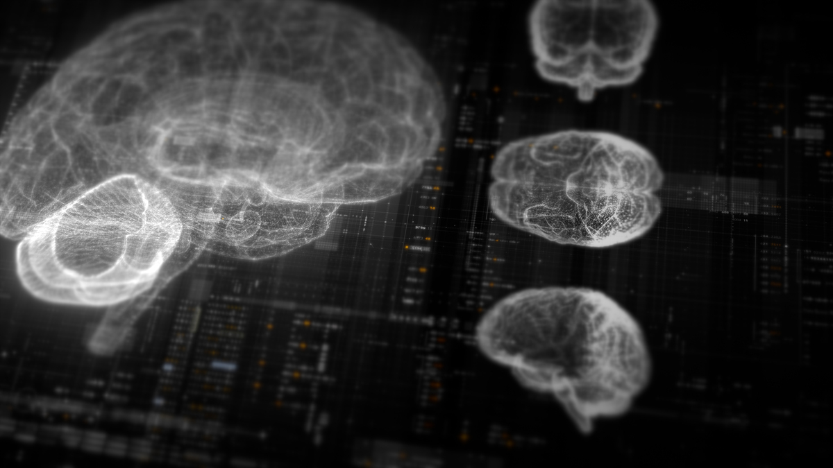 脑机接口：开启人类大脑与科技的奇幻之门 - 阶梯医疗Stairmed全栈式开发解决方案