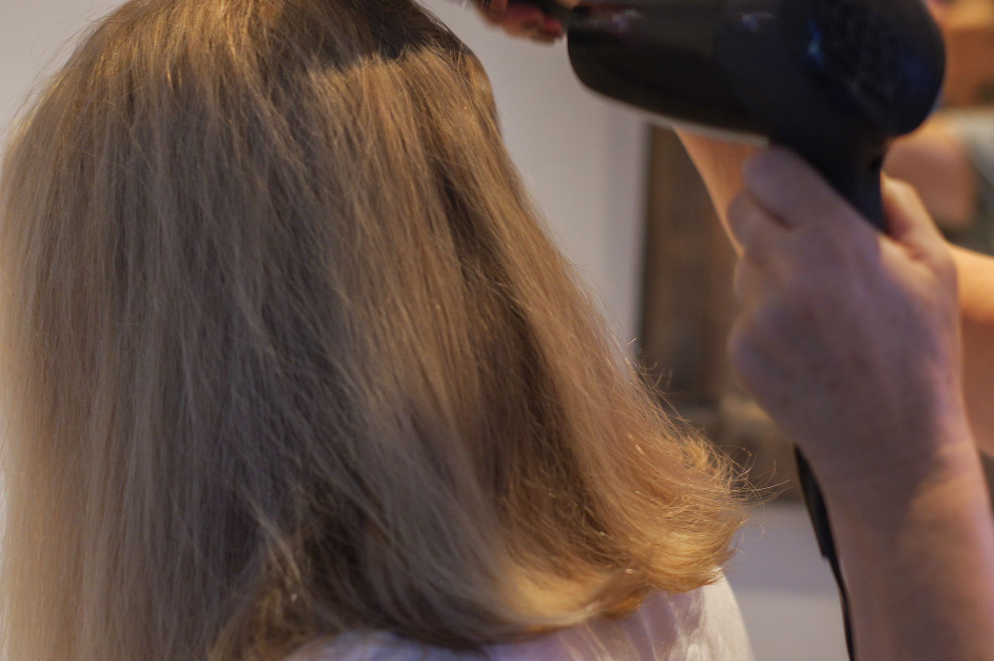 Can Hair Loss Be Completely Cured? (1000 Words)