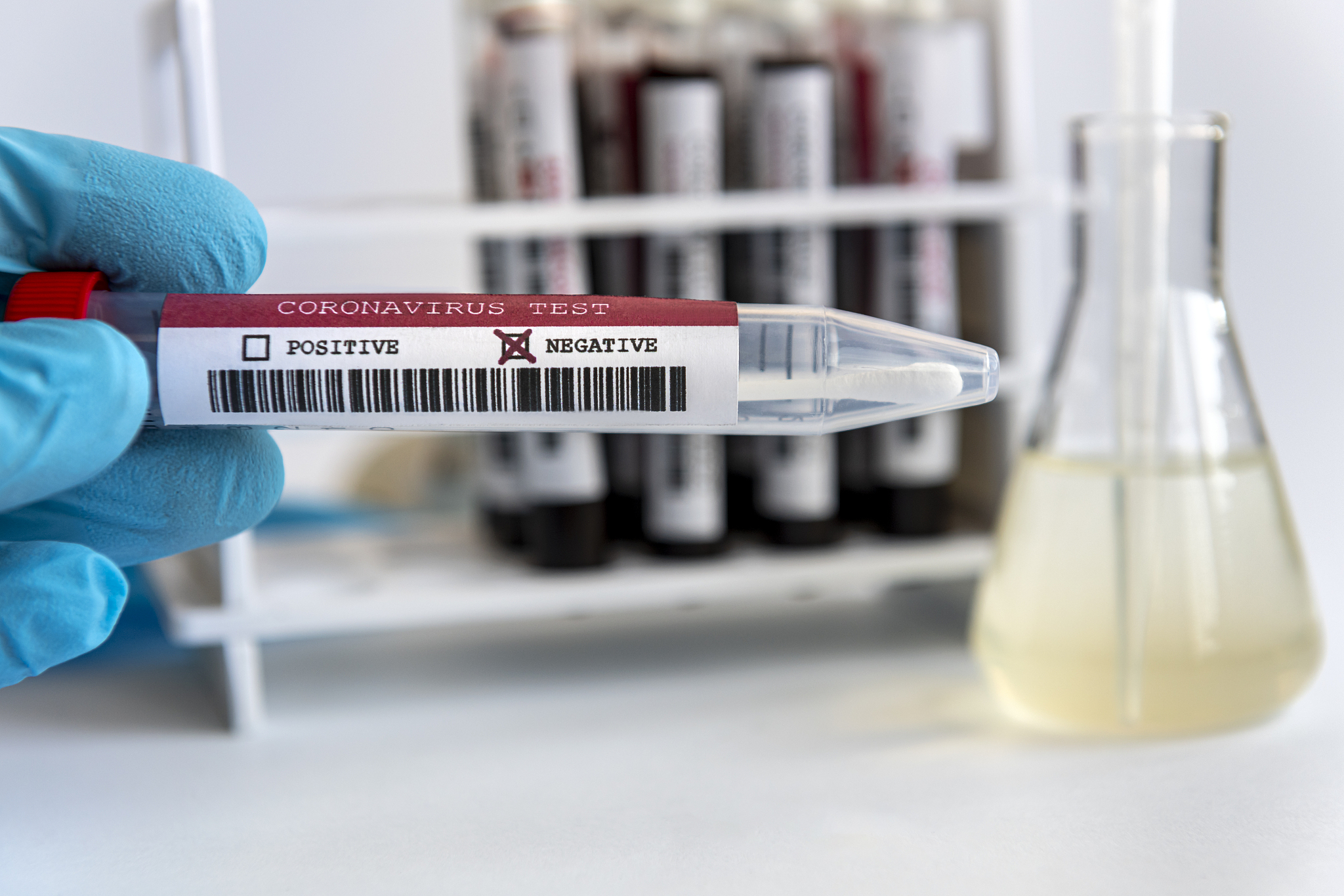 pH 3.5, 5.5, 7.5 溶液配方：柠檬酸、柠檬酸钠、HEPES