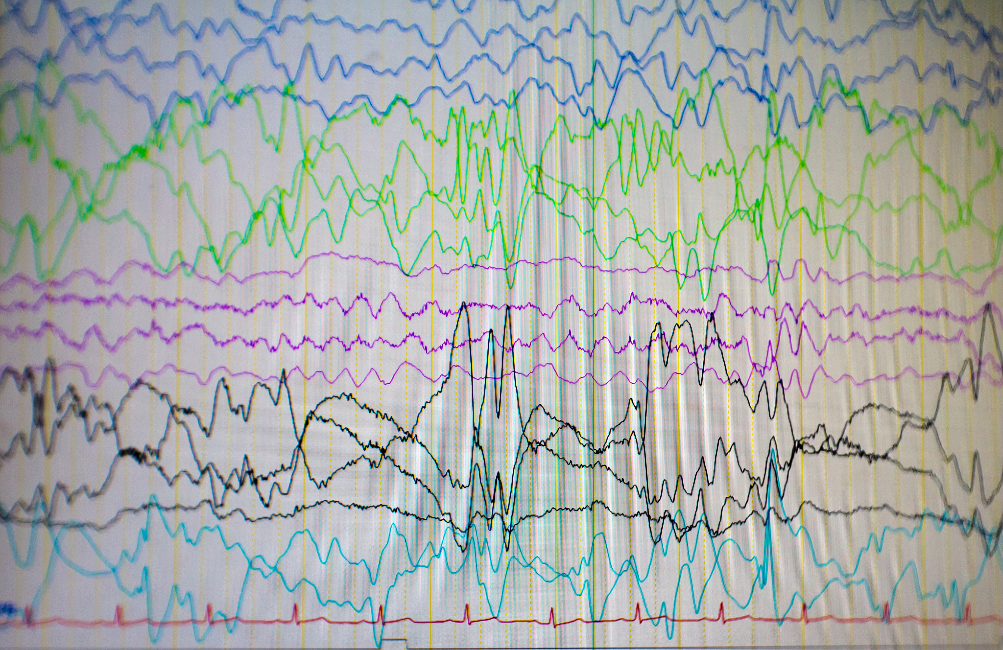 人工神经元与脑电波：接收机制、证明方法及模拟技术