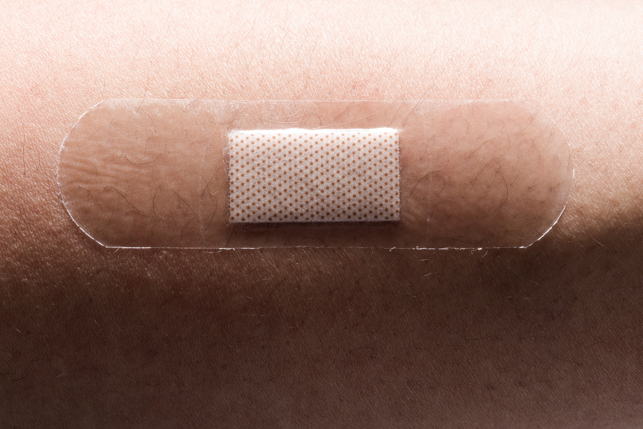 手术创面封闭生物胶：满足患者和医护的需求痛点