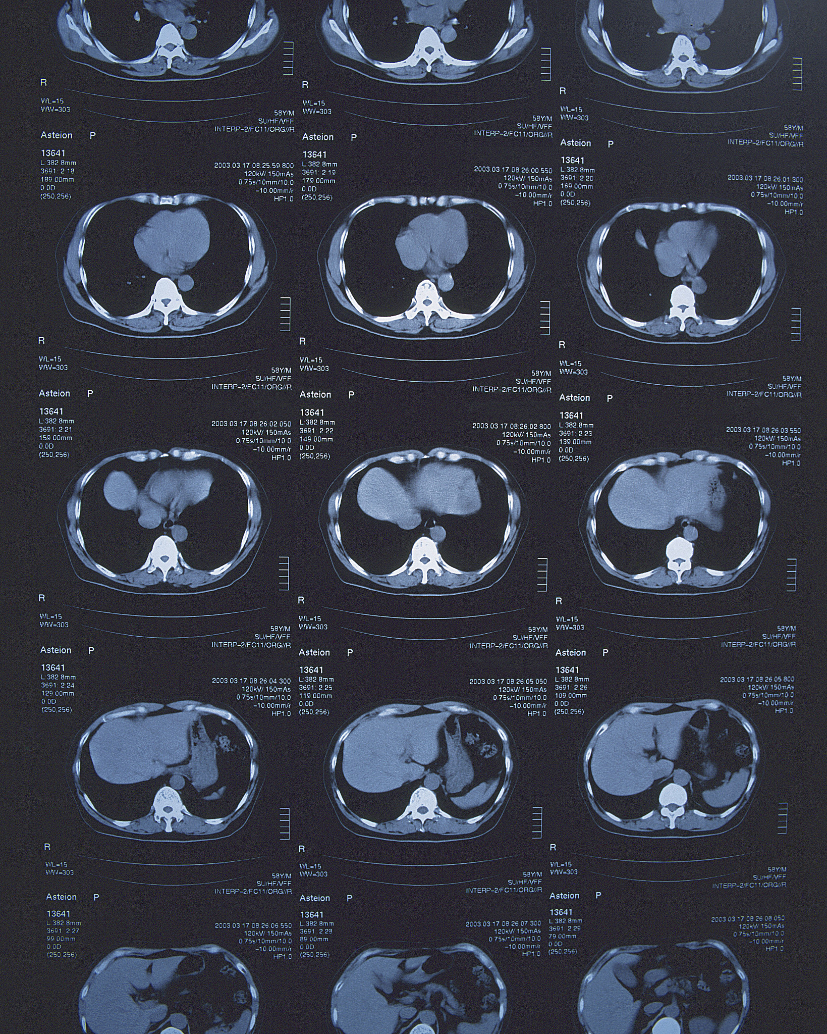 2022年南昌大学江西医学院医学影像学专业招生
