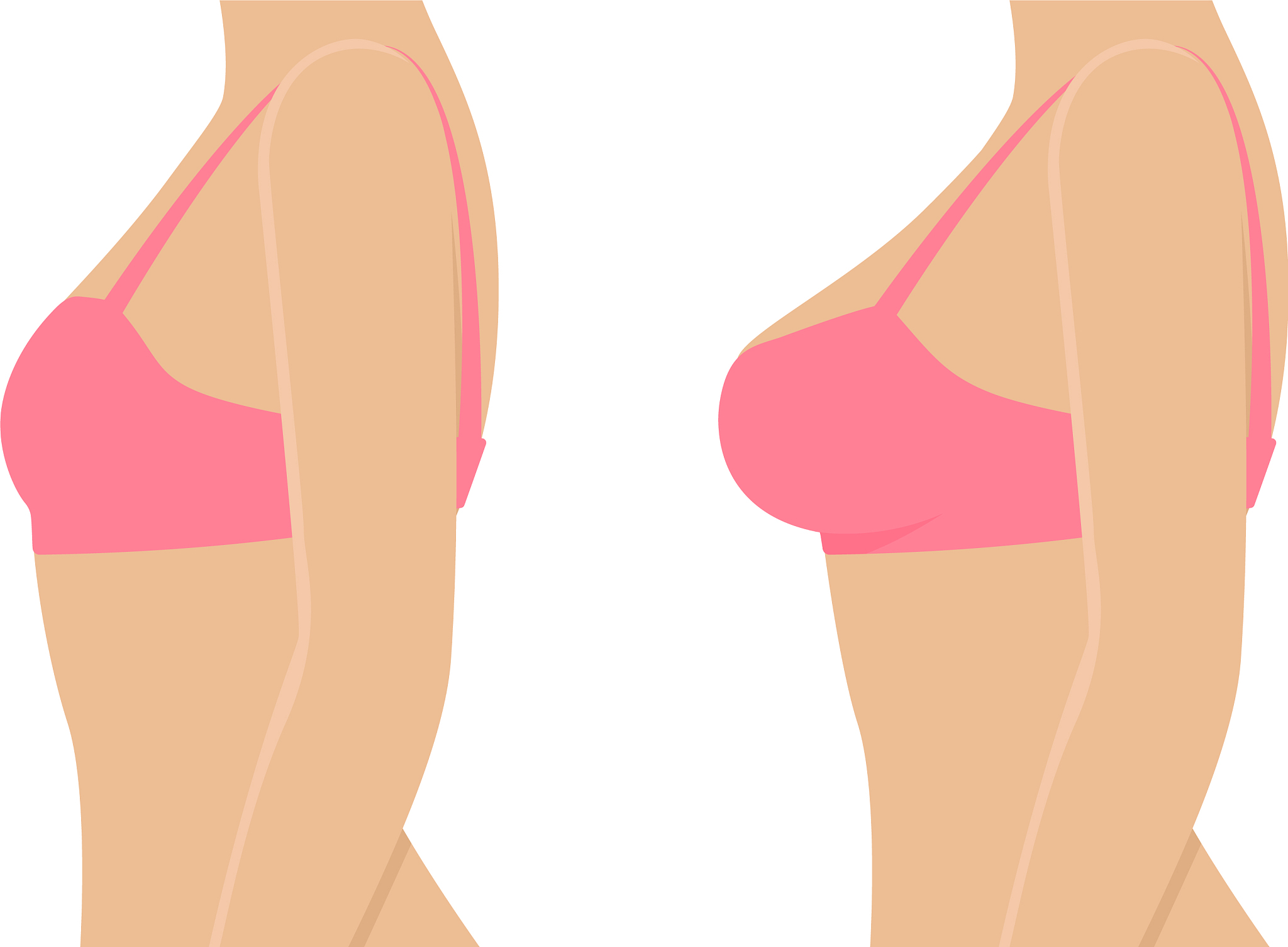 乳房太大如何缩小