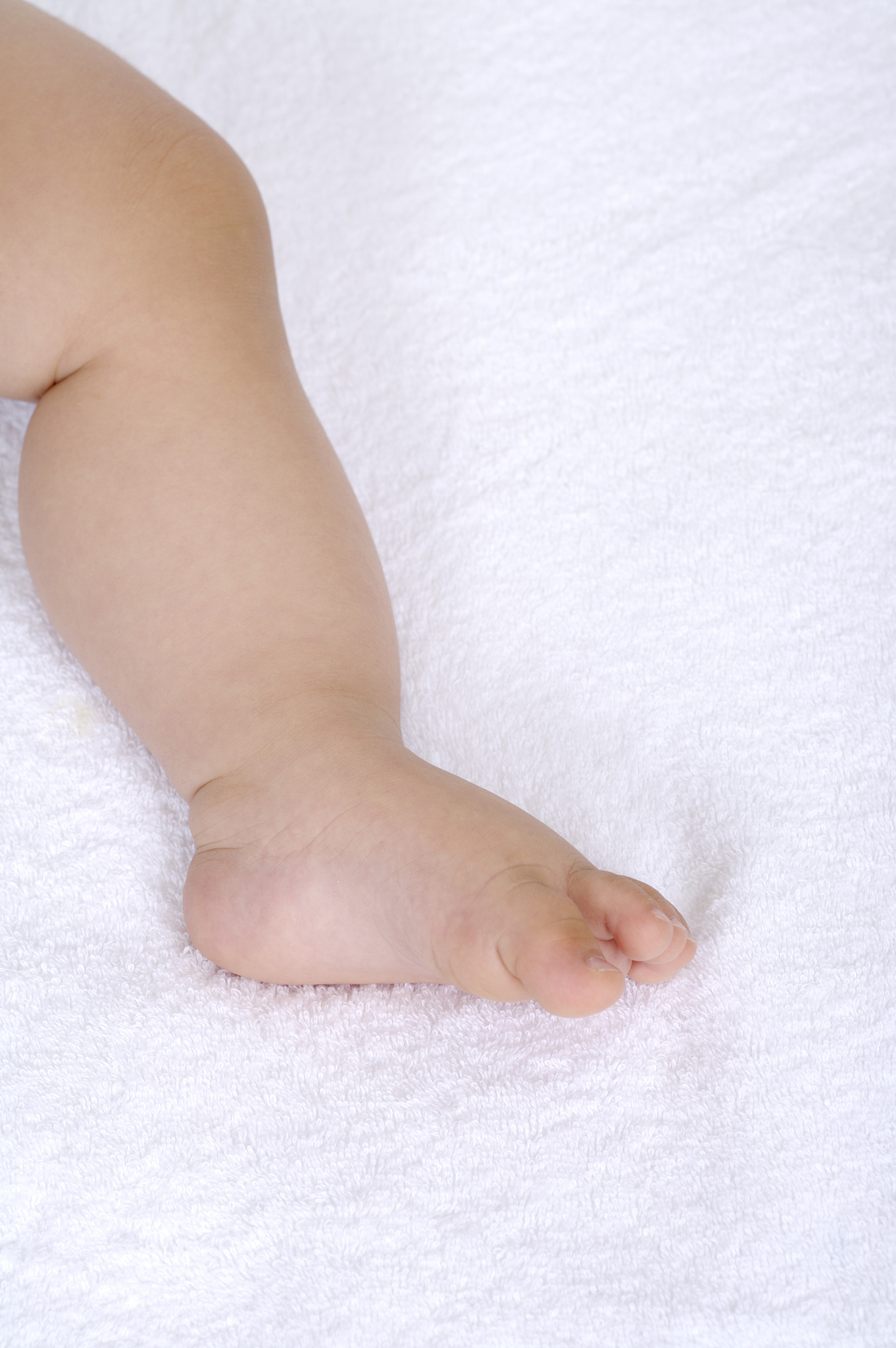 婴儿腿纹不一致正常吗？如何应对？