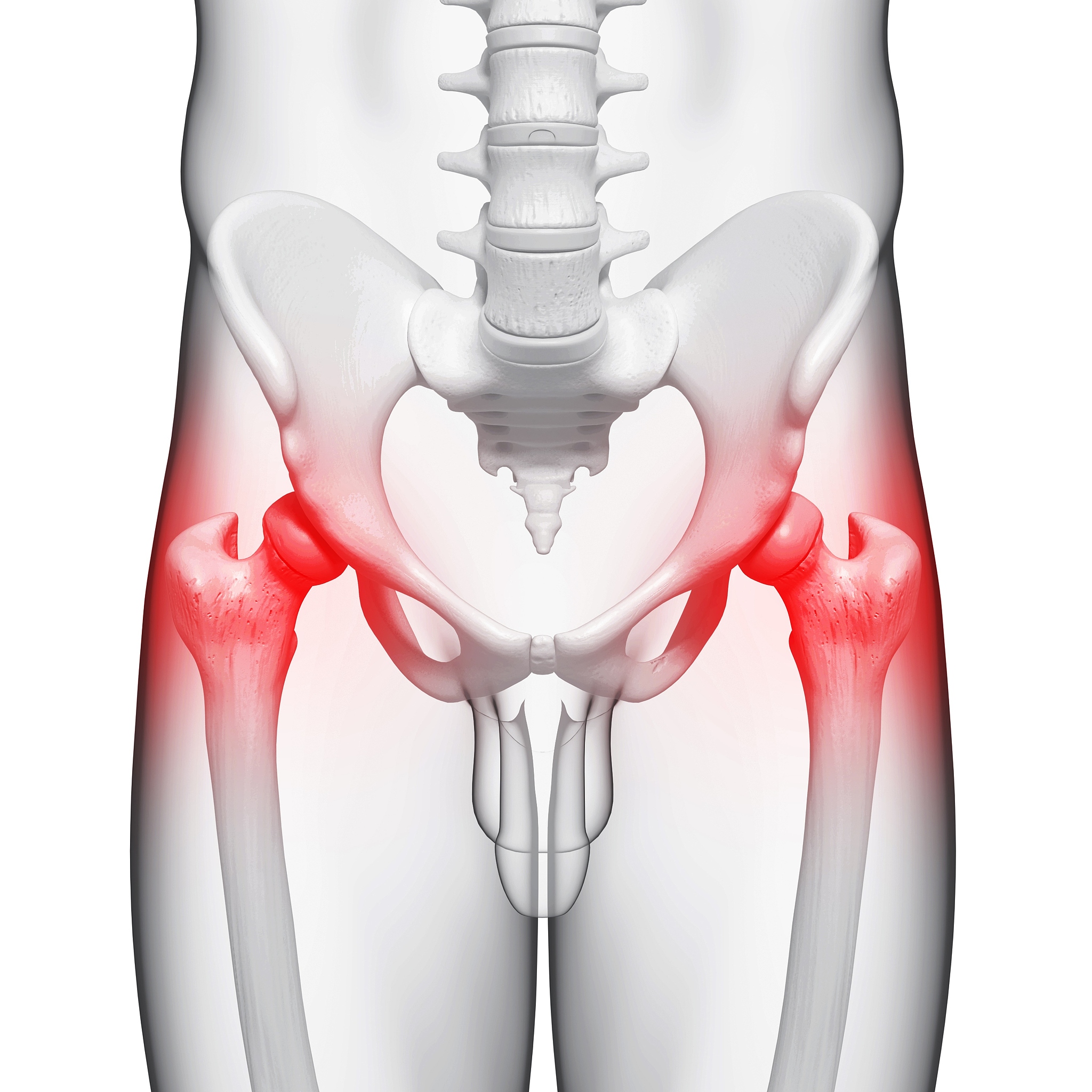 屁股左侧疼痛怎么办？原因、治疗和注意事项
