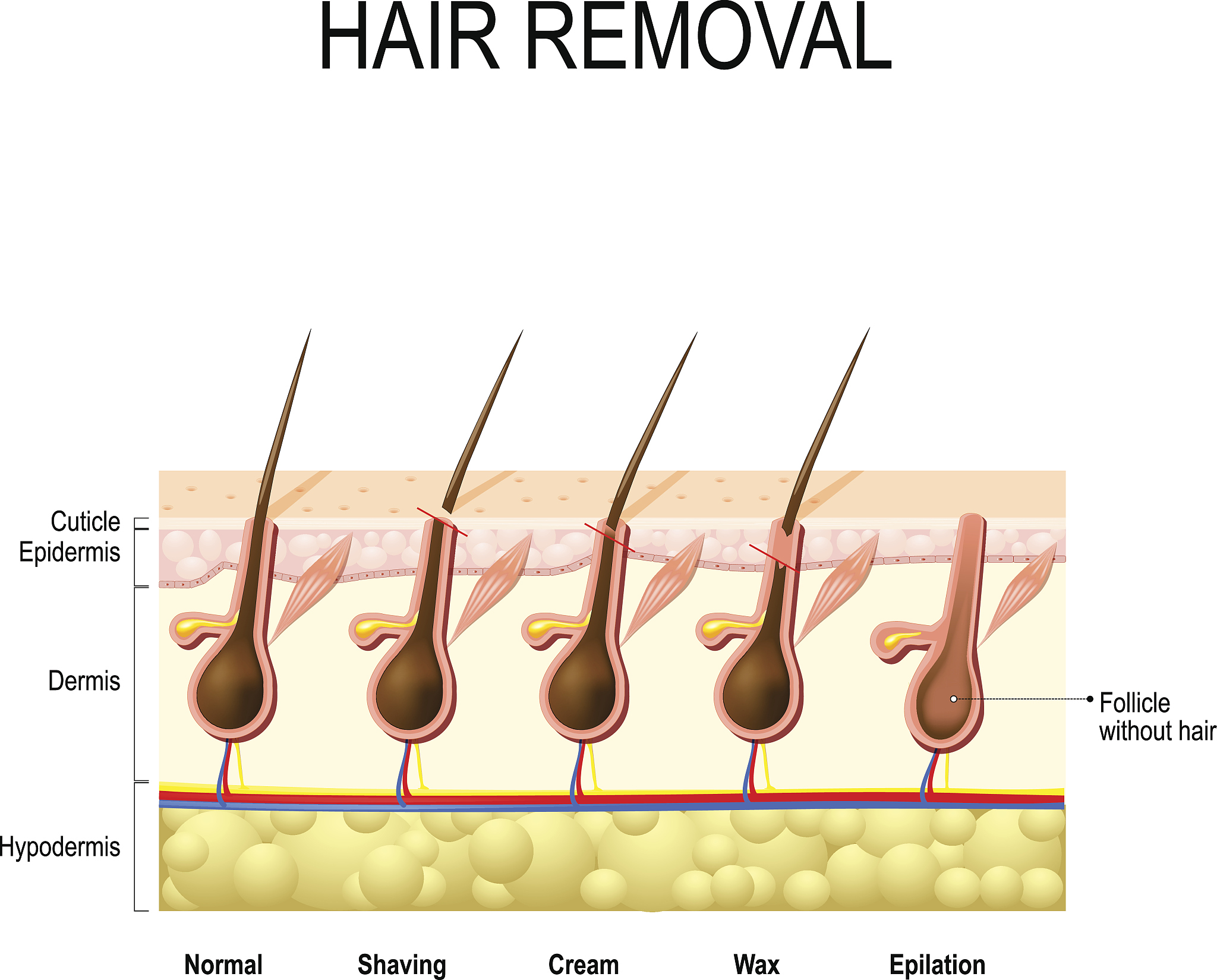 怎样预防毛囊炎