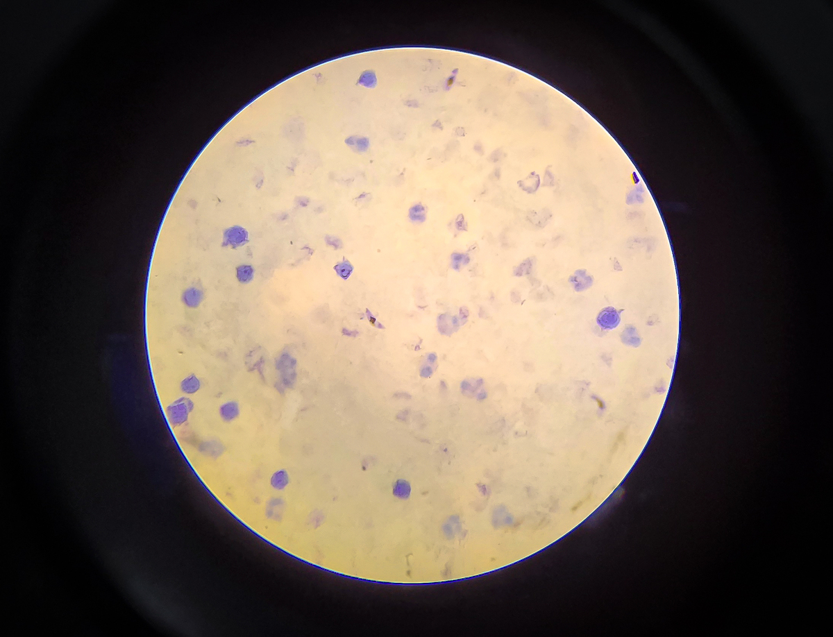 金黄色葡萄球菌诱导巨噬细胞分泌IL-6机制研究