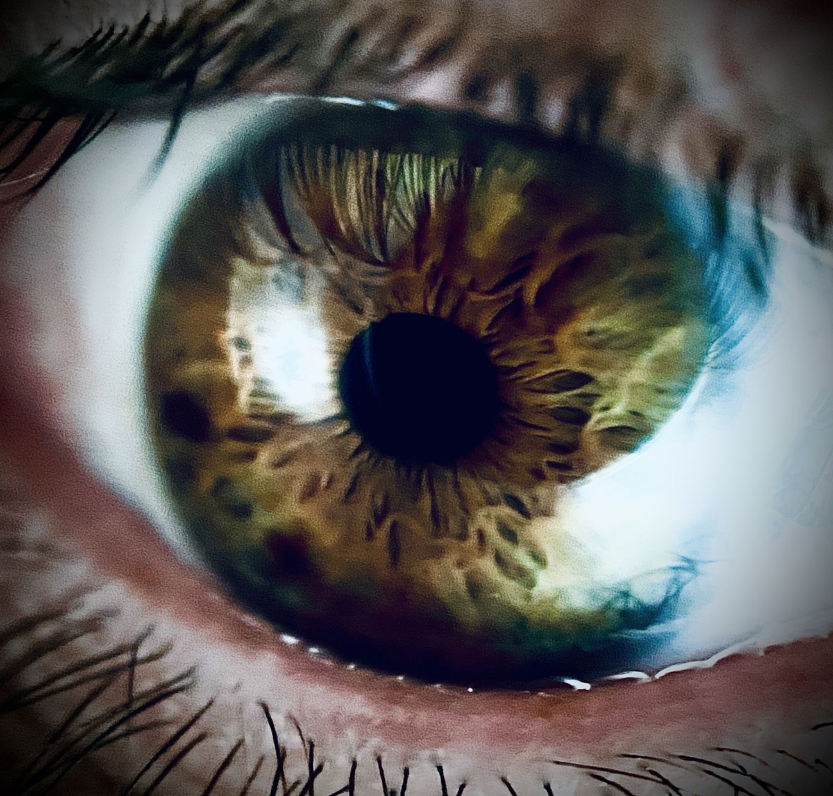 清光眼睛怎么治