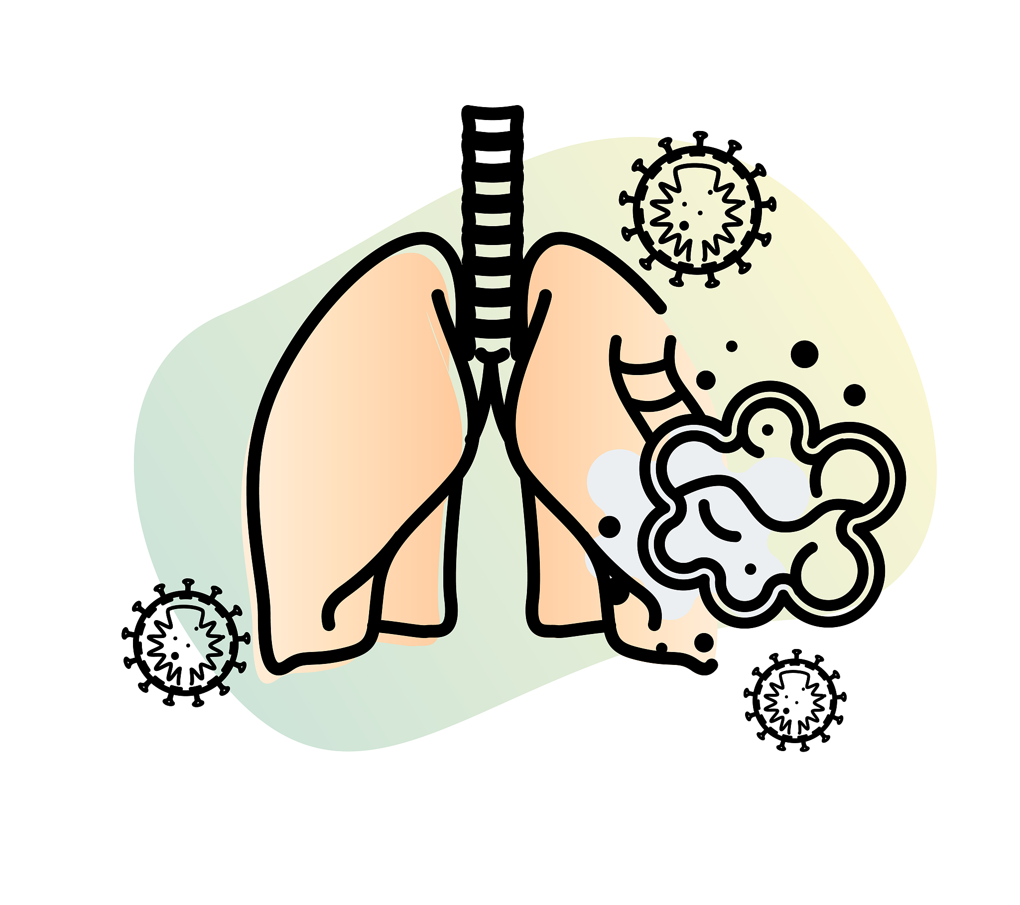 左肺上叶尖后段结节，Lung-RADS 4A类，3个月复查建议