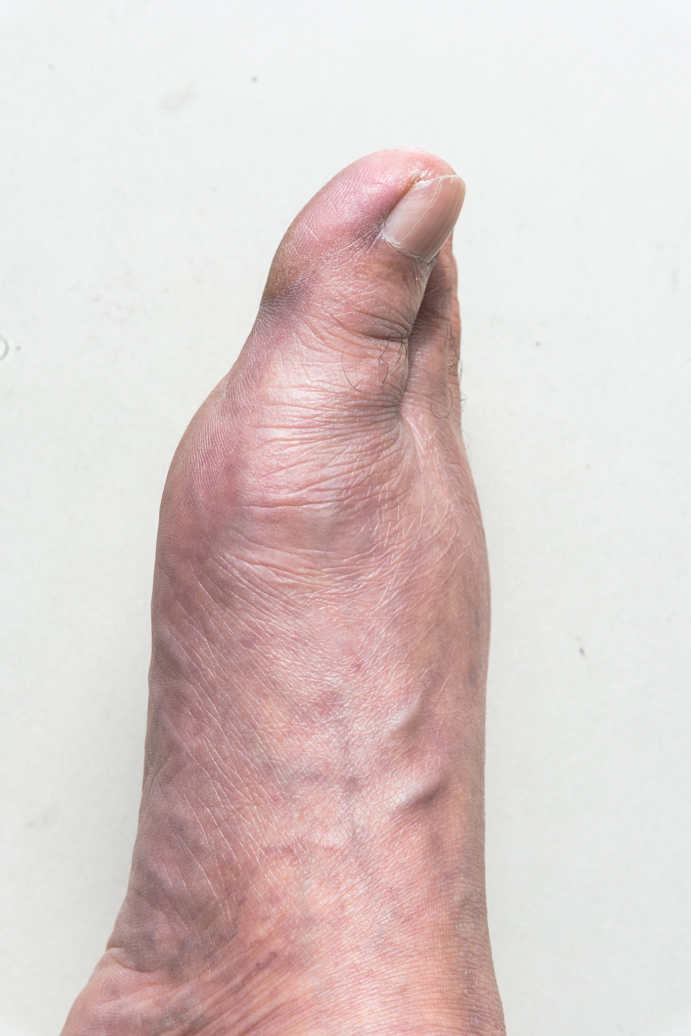 血府逐瘀胶囊的功效